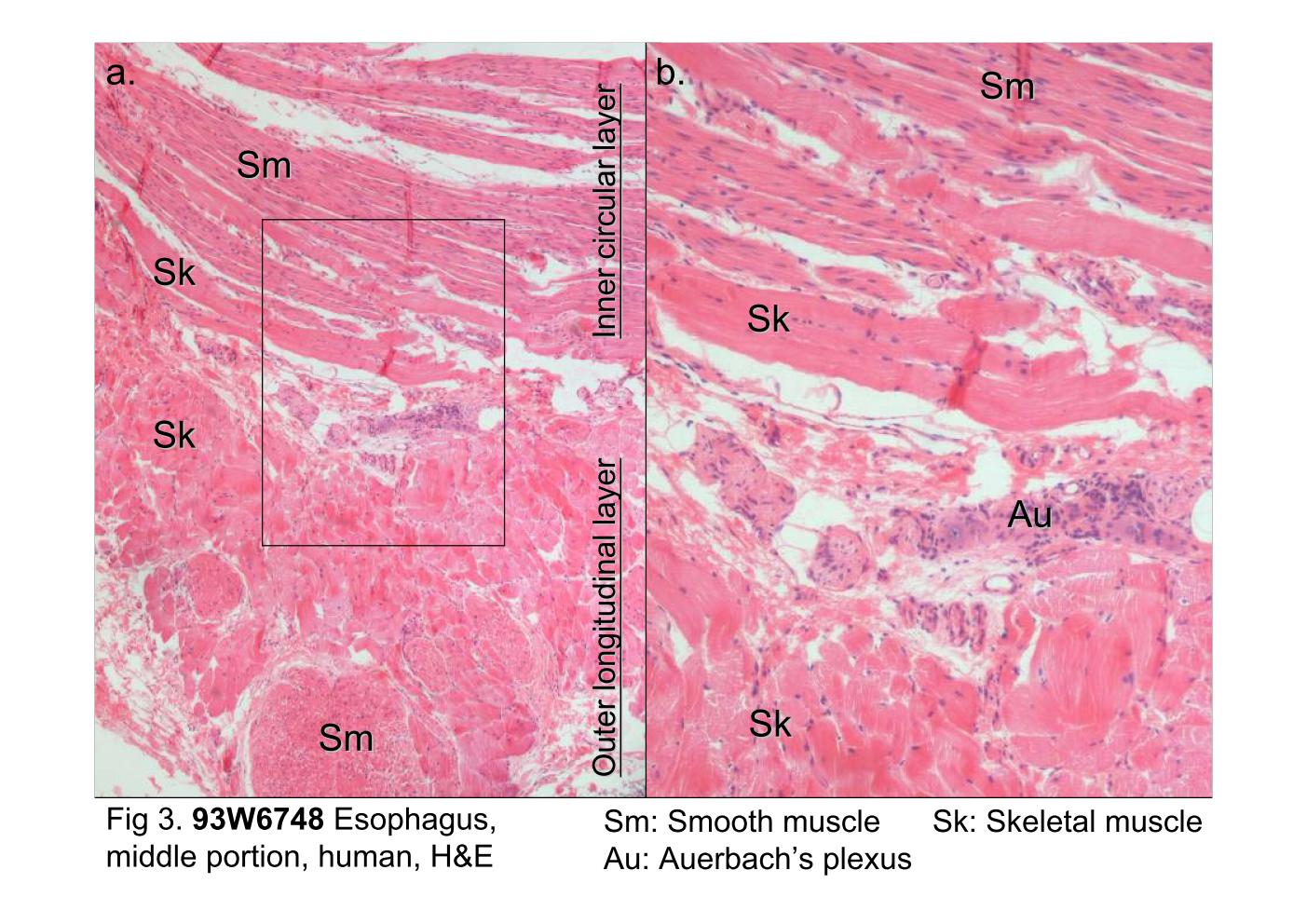 block10-1_09.jpg - Fig 3. The microscopic structure of the muscularis externaof the esophagus.The muscularis externa consists of two muscle layers, an innercircular layer and an outer longitudinal layer. The esophagus isdivided histologically into three regions on the basis of the typeof muscle which muscularis externa contains. At the middle thirdof the esophagus, skeletal muscle (Sk) and smooth muscle (Sm)bundles are mixed and interwoven in the muscularis externa.Located between the two muscle layers is a thin connectivetissue layer. Within this connective tissue lies the Auerbach'splexus (Au) containing nerve cell bodies of postganglionicparasympathetic neurons and neurons of the enteric nervoussystem, as well as blood vessels and lymphatic vessels. Therectangle of Fig 3a is examined at higher magnification in Fig 3b.