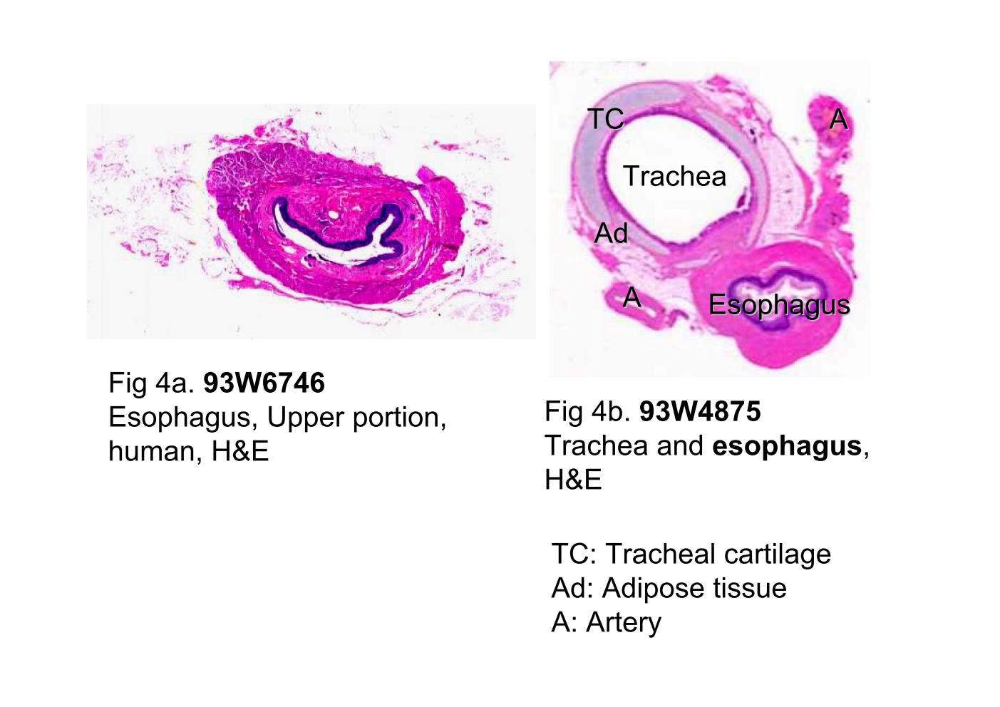 block10-1_11.jpg - Fig 4a. 93W6746 Esophagus, upper portion, human (cs) H&E.Fig 4b. 93W4875 Trachea and esophagus (cs) H&E.Both slides are taken from the upper portion of the esophagus.(Fig 4b shows the relationship between the trachea and theesophagus at the base of the neck.) All histological features ofthe upper portion of the esophagus are similar to its middleportion except the muscularis externa of the upper one third iscomposed of striated muscle. Please find similar structures in93W6748.