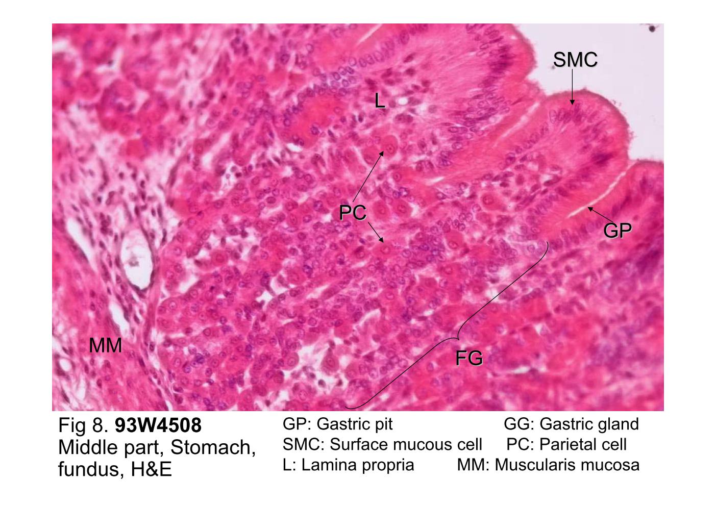 stomach histology gastric pit
