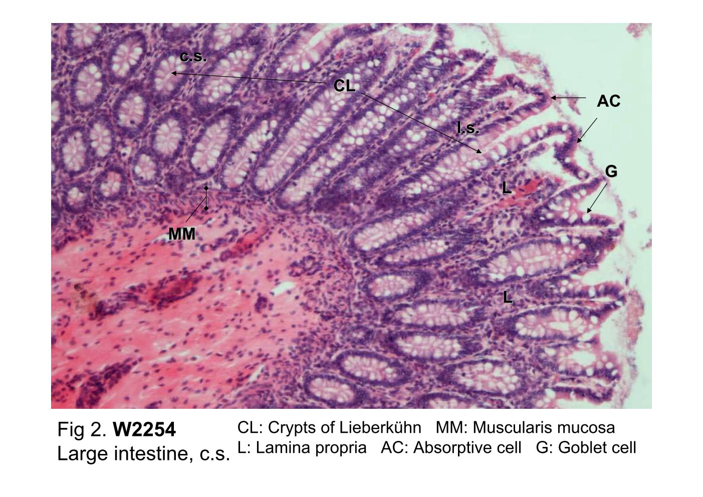 block10-2_07.jpg - Fig 2. W2254, Large intestine (cs) H&E.The mucosa contains straight, simple tubular glands -- Cryptsof Lieberkuhn (CL) -- that extend to the muscularis mucosa(MM). Between the glands is a lamina propria (L) that containsconsiderable numbers of lymphocytes and other cells of theimmune system. The cells that line the surface of the colonand the glands are principally absorptive cells (AC) and gobletcells (GC).