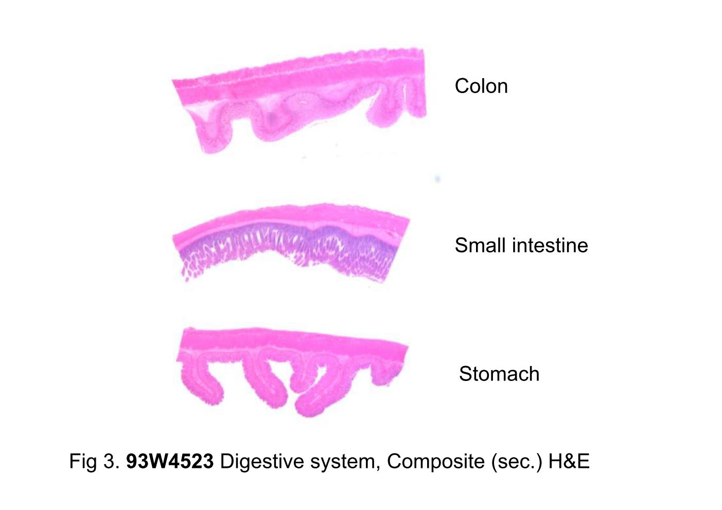 block10-2_09.jpg - Fig 3. 93W4523, Digestive system, Composite (sec.) H&E.There are three tissues in this slide: upper, colon; middle,small intestine; lower, stomach. The histological features havebeen mentioned already. Please compare the histologicalcharacteristic among three organs.