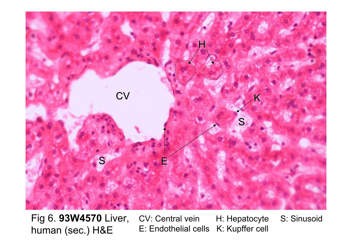 block10-2_15.jpg - Fig 6. 93W4570, Liver, human (sec.) H&E.The central vein (CV) and surrounding hepatocytes (H) areshown in this figure at high magnification. Hepatocytes are largepolyhedral cells with round nuclei and are arranged in one-cell-thick plates. The plates of the hepatocytes exhibit a radialarrangement toward the central vein. The sinusoid (S) appearsas light areas between the cords of the hepatic cells. The cellsthat line the sinusoids are endothelial cells (E) [squamous cell,elongated nuclei] and Kupffer cells (K) [ovoid nuclei].If you examine the outer surface of this slide, you would find thetissue is covered by a capsule composed of collagenous tissuecalled Glisson's capsule. Over the Glisson's capsule is a layerof mesothelial cells from the peritoneum.