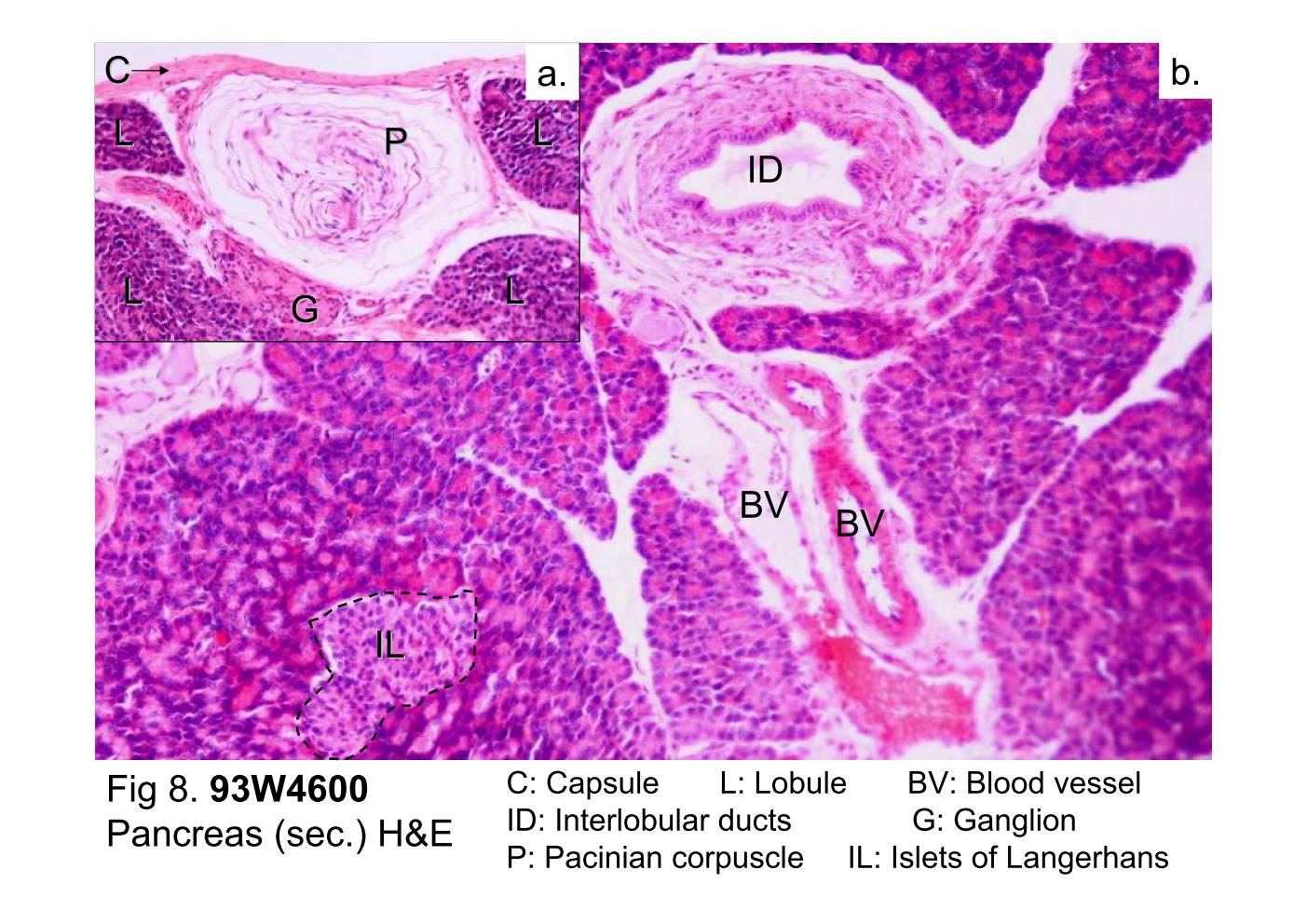 block10-2_19.jpg - Fig 8. 93W4600, Pancreas (sec.) H&E.The pancreas is surrounded by a delicate capsule (C) ofmoderately dense connective tissue. Septa from the capsuledivide the pancreas into lobules (L). Larger blood vessels (BV)and interlobular ducts (ID) travel in the connective tissue septa.Ganglion (G) and Pacinian corpuscle (P) can also be found inthis slide.Pancreas is a mixed gland containing both an exocrinecomponent (pancreatic acini) and an endocrine component(islet of Langerhans, IL), that have distinctive characteristics.Within the lobule are the numerous pancreatic acini, anintralobular duct, intercalated ducts [not readily evident at thislow magnification], and islet of Langerhans.