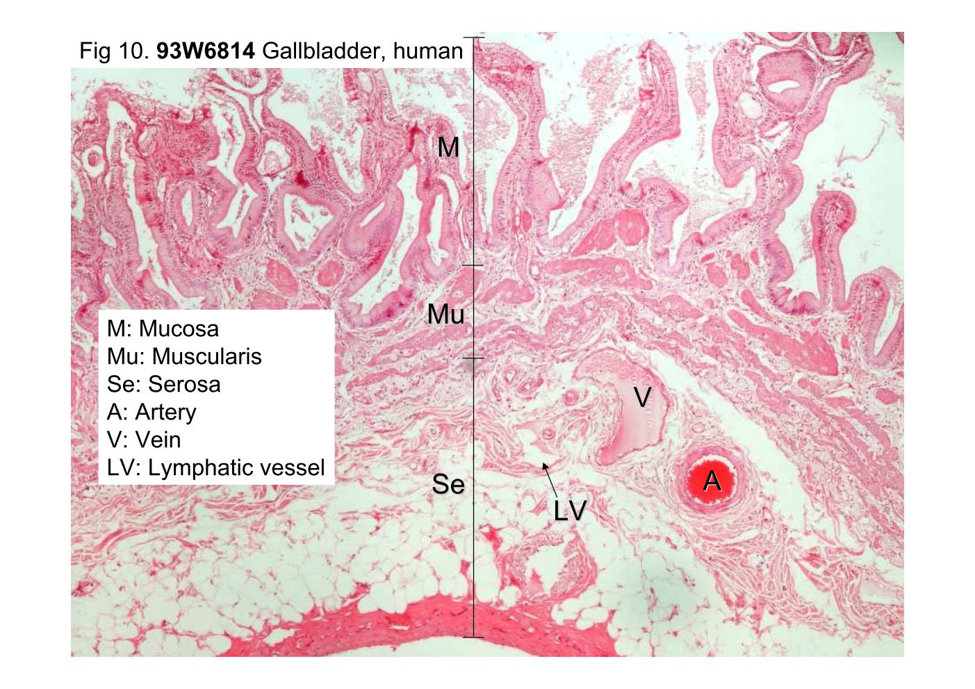 block10-2_23.jpg - Fig 10. 93W6814, Gallbladder, human, H&E.The wall of the gallbladder is composed of a mucosa (M),muscularis (Mu) and serosa (Se). The mucosa is thrown intonumerous folds. The muscularis consists of interlacing bundlesof smooth muscle. The serosa consists of irregular denseconnective tissue through which the artery (A), vein (V), andlymphatic vessel (LV) travel; and containing abundant adiposetissue.
