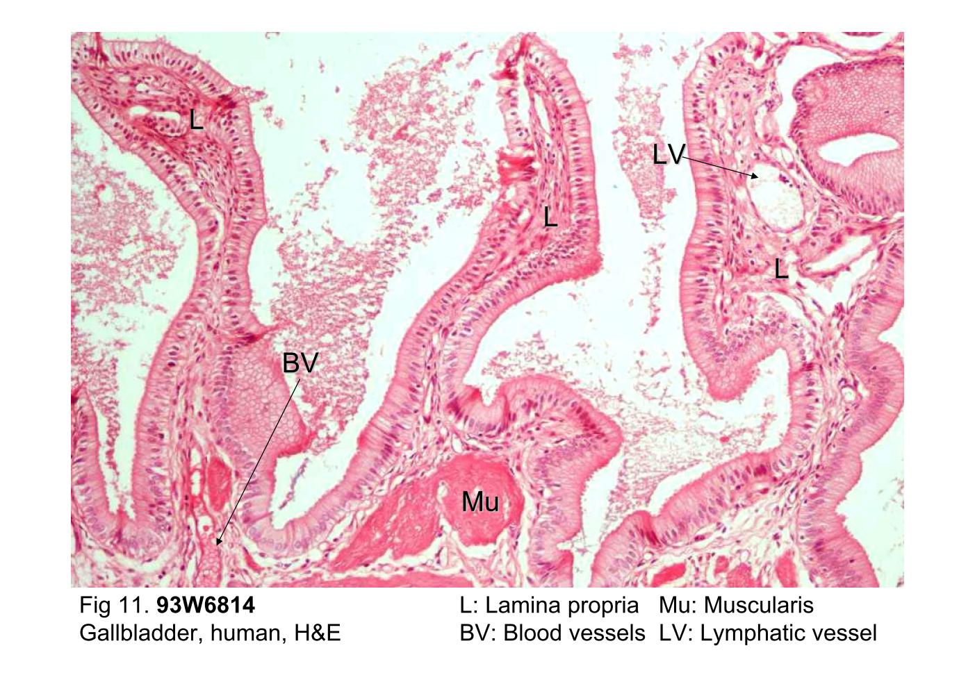 block10-2_25.jpg - Fig 11. 93W6814, Gallbladder, human, H&E.The mucosa consists of a tall simple columnar absorptiveepithelium resting on a lamina propria (L) of loose connectivetissue. Only one cell type, tall columnar cells, is present in theepithelial layer. The nuclei are in the basal portion of the cell.The cells possess a thin apical striated border. The laminapropria underlying the epithelium is usually very cellularcontaining lymphocytes, the blood vessel (BV) and lymphaticvessels (LV).