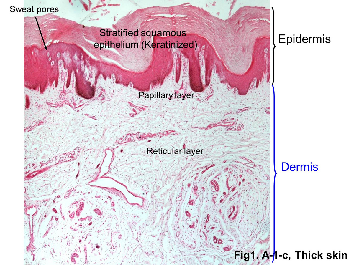 block15_05.jpg - Fig.1 Micrograph of skin. The skin has three main layers: epidermis, dermis and hypodermis. Epidermis have an outer keratinising stratified squamous epithelium. Dermis have tough supporting and nourishing layer of fibroelastic tissue. Hypodermis (not shown in this graph) is a variable deep layer, mainly adipose tissue (please see Fig.2).
