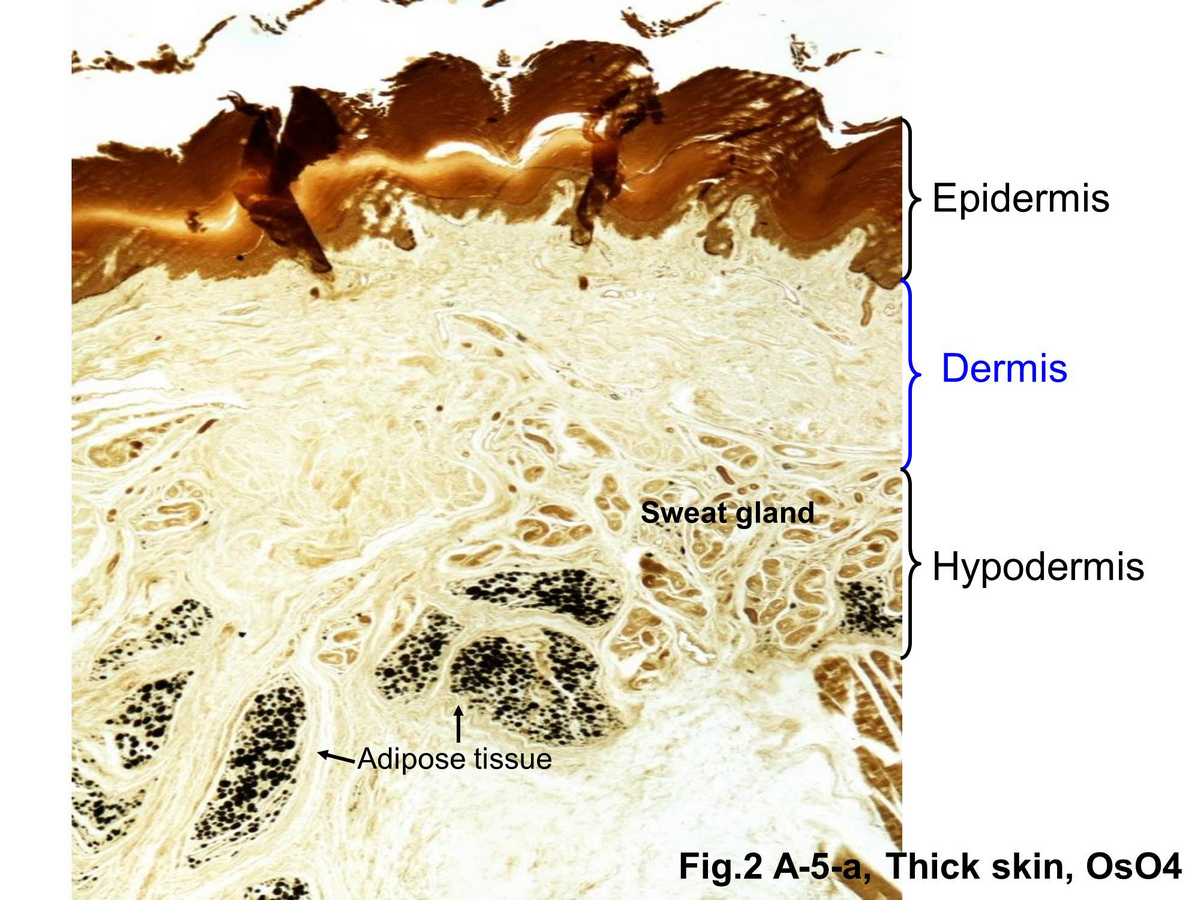 block15_07.jpg - Fig.2 Micrograph of skin stained with osmium tetroxide (OsO4). Osmium tetroxide is used as a stain for lipids in optical microscopy. Thus, adipose tissue can be found with higher contrasts in the hypodermis.