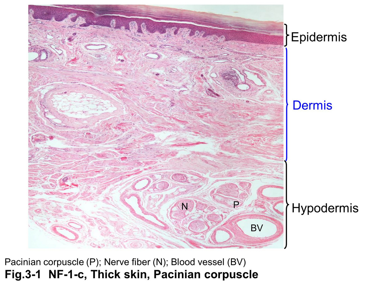block15_09.jpg - Fig.3-1 Micrograph of skin. A full view with three layers. Pacinian corpuscle can be found of in the hypodermis.