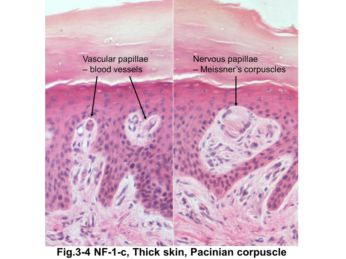 block15_15.jpg - Fig. 3-4 Higher magnification of the Meissner��s corpuscle. Messiner��s corpuscle are small, encapsulated, sensory receptors found in the dermis of skin. They are oval in shape, usually located in the dermal papillae and involved in the reception of light discriminatory touch.
