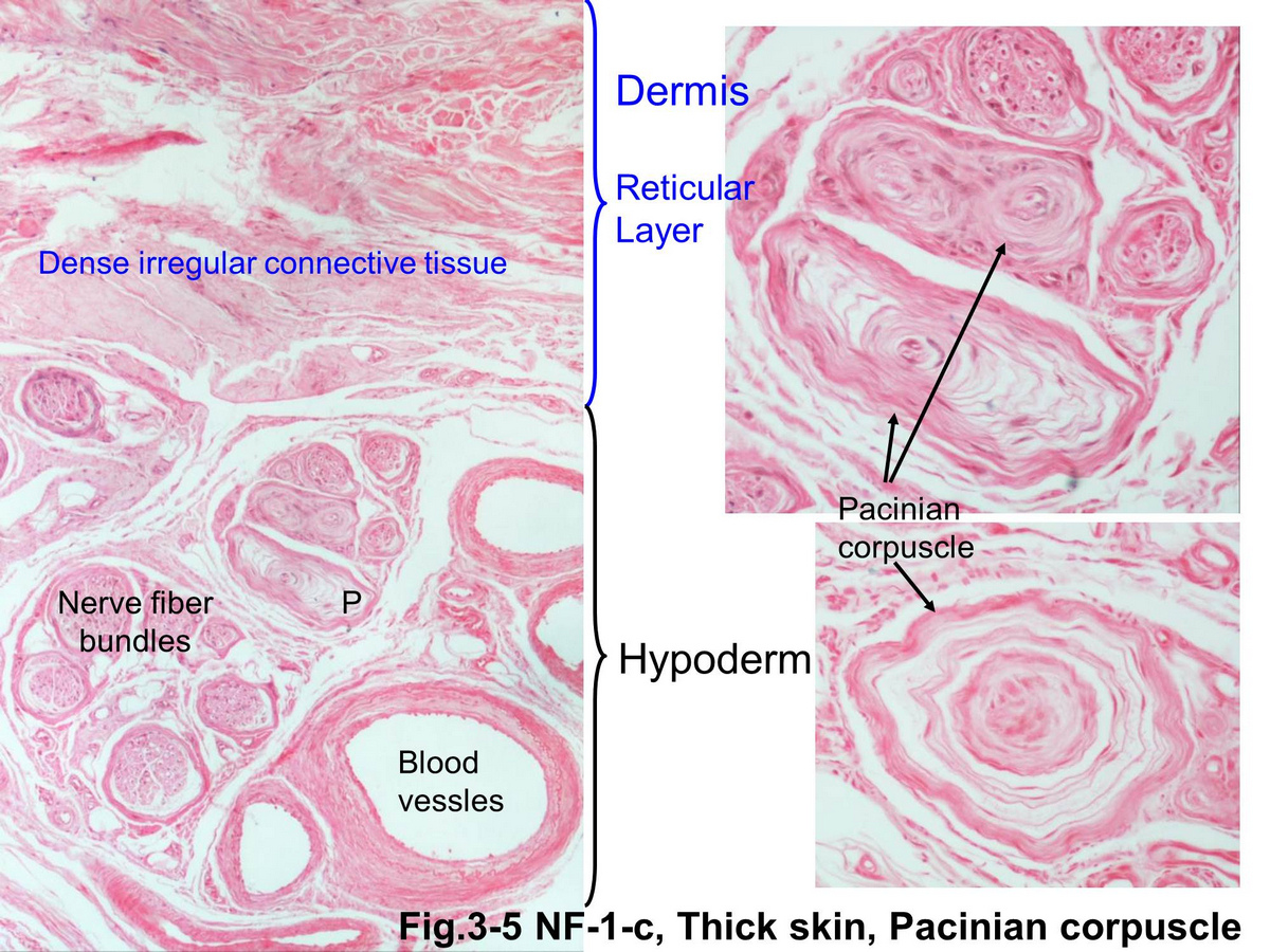 block15_17.jpg - Fig. 3-5 Higher magnification of the Pacinian corpuscle. Pacinian corpuscle are deep pressure receptors for mechanical and vibratory pressure. They are found in deep dermisand hypodermis as well as in connective tissue in joints and internal organs. Distortion of the Pacinian corpuscle produces an amplified mechanical stimulus in the core which istransduced into an action potential in the sensory neuron.