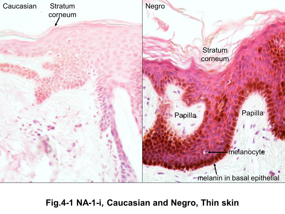 block15_19.jpg - Fig. 4-1 Comparison of skin of Caucasian and Negro. Observe the structure in both sections and see the melanin, which is produced by the melanocytes, appears in the basal cells of the stratum basale.