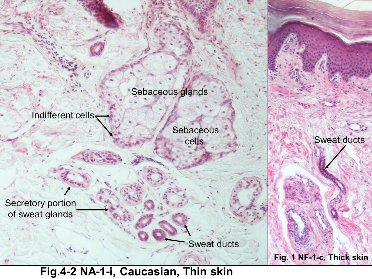 block15_21.jpg - Fig. 4-2 Sebaceous glands and sweat glands. Sebaceous glands secrete sebum thatcoats the hair and skin surface. Sweat gland is arranged as a simple coiled tubular structure composed of a secretory segment located deep in the dermis or in the upper part of the hypodermis and a directly continuous duct segment that leads to the epidermal surface.