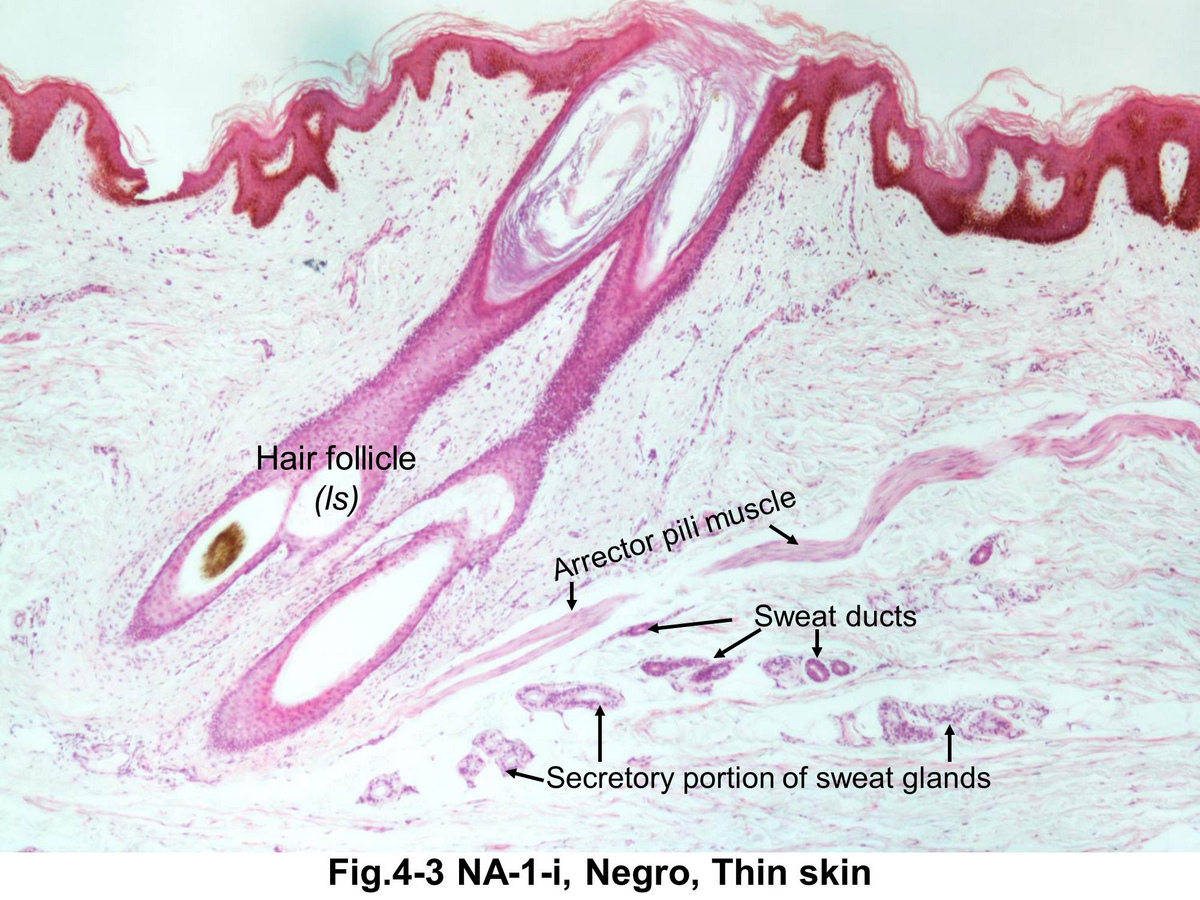block15_23.jpg - Fig. 4-3 Hair follicle. Hair follicle is responsible for the production and growth of a hair. The follicle is surrounded by a connective tissue sheath to which the arrector pili muscle is attached.