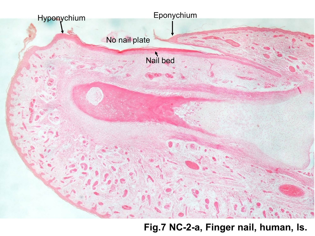 block15_29.jpg - Fig. 7 Nail. The slightly arched fingernail or toenail rests on the nail bed. The bed consists of epithelial cells that are continuous with the stratum basale and stratum spinosum of the epidermis. The edge of the skin fold covering the root of the nail is the eponychium. A thickened epidermal layer, the hyponychium, secures the free edge of the nail plate at the fingertip.