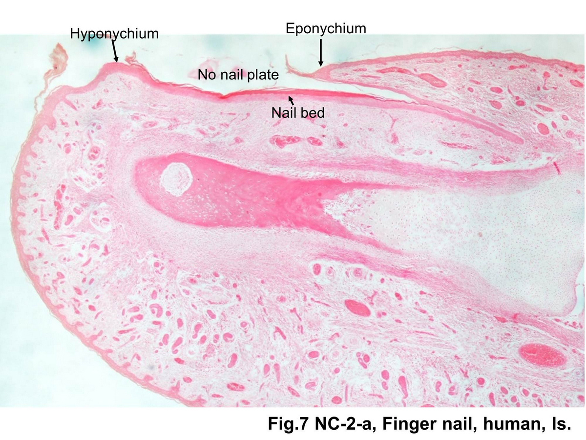 Eponychium Histology Nail Histopathology Actas
