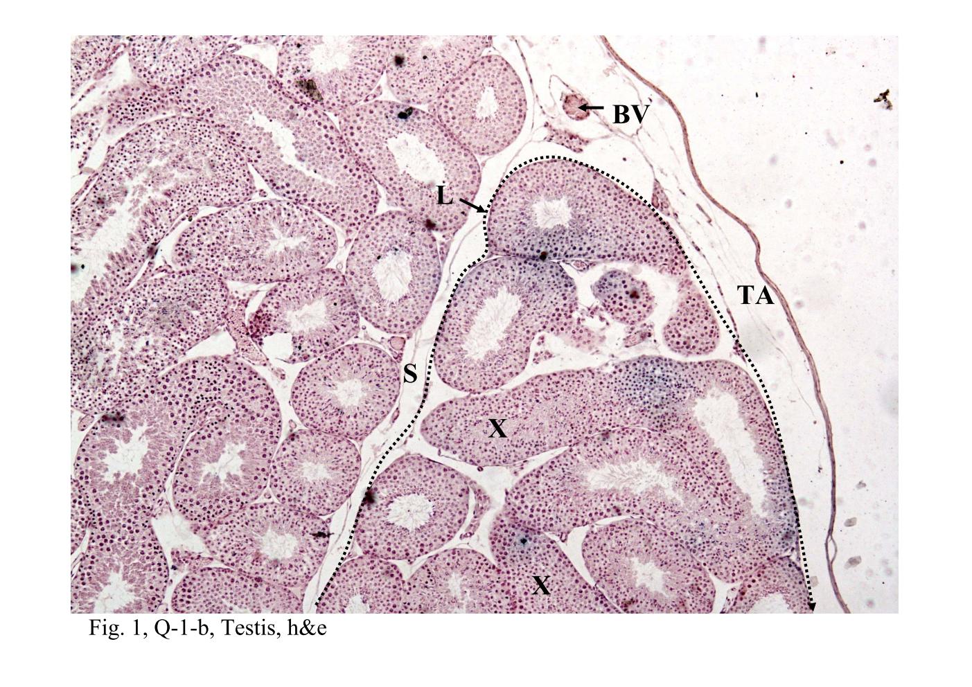 block14_05.jpg - Fig. 1 & 2, Q-1-b, Testis, h&e; 93W7206, Testis, ihThe seminiferous tubules and the tunica albuginea (TA or capsule) of the testis   organ are identified in this section. Extending from the capsule are connective   tissue septa (S) that divide the organ into several ( about 250) compartments or   lobules. Each compartment (L ¡V corresponding to a lobule) contains coiled   seminiferous tubules. Blood vessels (BV) are abundant under the capsule that   located between the tunica albuginea and seminiferous tubules is referred as the   tunica vasculosa. The branches of the blood vessels extending within the   connective tissue septa are also observed.The seminiferous tubules are convoluted, therefore, the profiles of them present in a   section are variable in appearance. Sometimes, the wall of a tubule is sectioned   tangentially, thus obscuring the lumen and revealing what appears to be a solid   mass of cells (X).