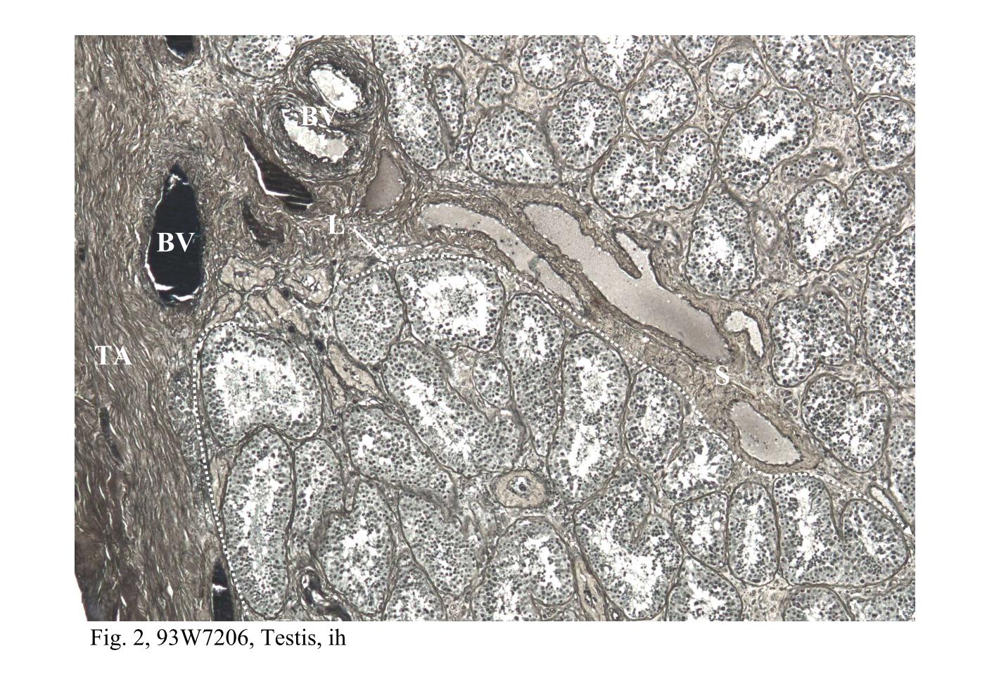 block14_06.jpg - Fig. 1 & 2, Q-1-b, Testis, h&e; 93W7206, Testis, ihThe seminiferous tubules and the tunica albuginea (TA or capsule) of the testis   organ are identified in this section. Extending from the capsule are connective   tissue septa (S) that divide the organ into several ( about 250) compartments or   lobules. Each compartment (L ¡V corresponding to a lobule) contains coiled   seminiferous tubules. Blood vessels (BV) are abundant under the capsule that   located between the tunica albuginea and seminiferous tubules is referred as the   tunica vasculosa. The branches of the blood vessels extending within the   connective tissue septa are also observed.The seminiferous tubules are convoluted, therefore, the profiles of them present in a   section are variable in appearance. Sometimes, the wall of a tubule is sectioned   tangentially, thus obscuring the lumen and revealing what appears to be a solid   mass of cells (X).