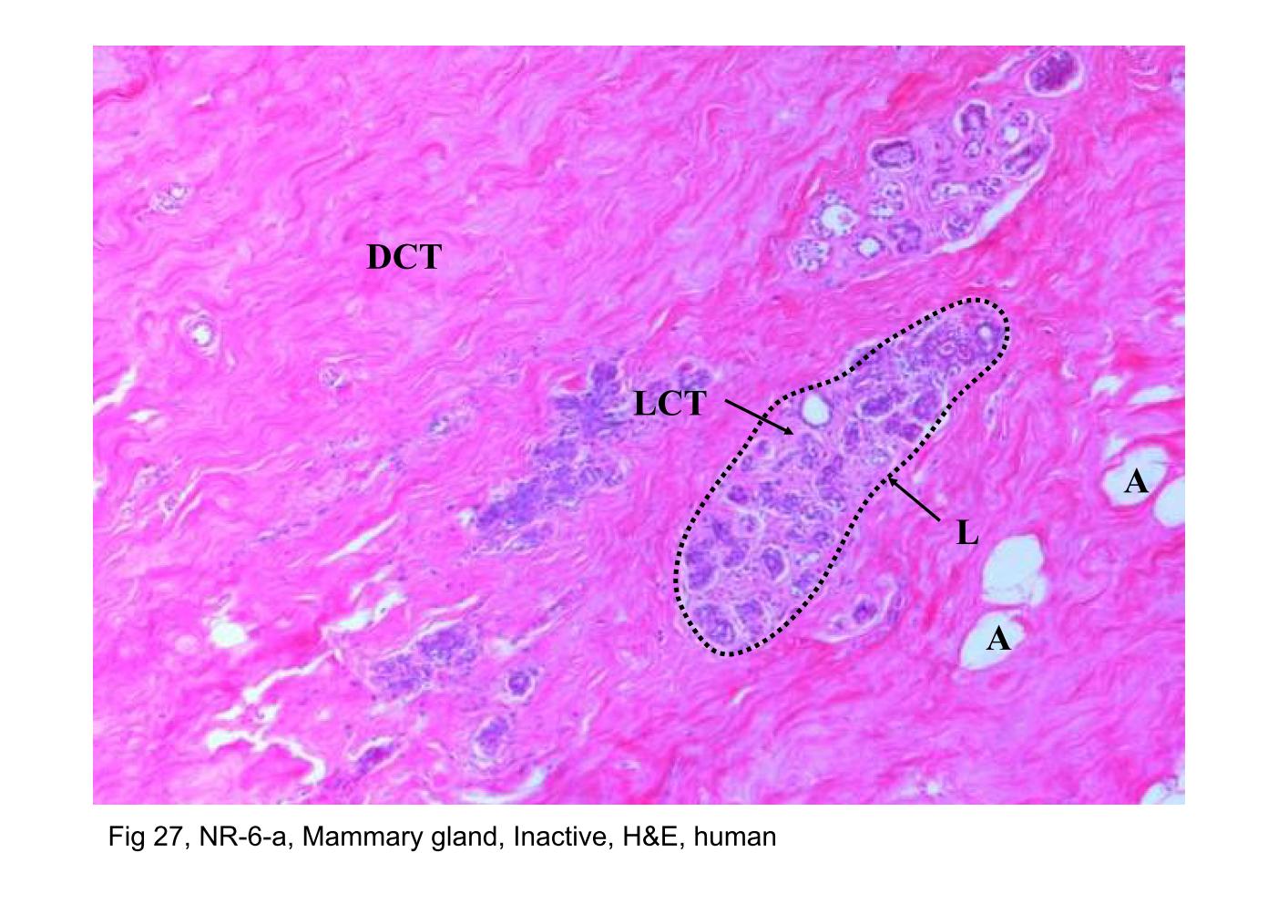 block14_53.jpg - Fig 27, NR-6-a, Mammary gland, Inactive, H&E, humanThis figure is a section through an inactive mammary gland. The  parenchyma is sparse and consists mainly of duct elements. The  ducts are surrounded by a loose connective tissue (LCT), and  together, the ducts and surrounding connective tissue constitute a  lobule (L). Beyond the lobule, the connective tissue is the dense  connective tissue (DCT). Characteristically, the dense connective  tissue contains numerous aggregates of adipocytes (A).