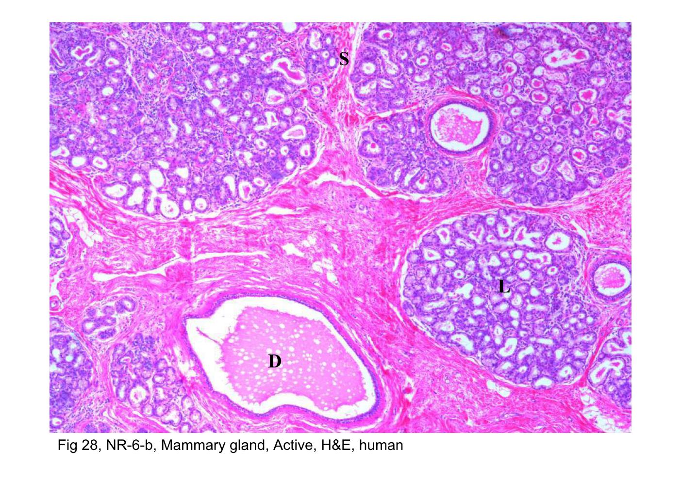 block14_55.jpg - Fig 28, NR-6-b, Mammary gland, Active, H&E, humanThis figure shows the lobules (L) of the active mammary gland.  Individual lobules are separated by narrow dense connective tissue  septa (S) .The connective tissue within the lobule is a typical loose  connective tissue that is now more cellular. The interlobular ducts  (D) are easy to identify as they are surrounded by dense connective  tissue.