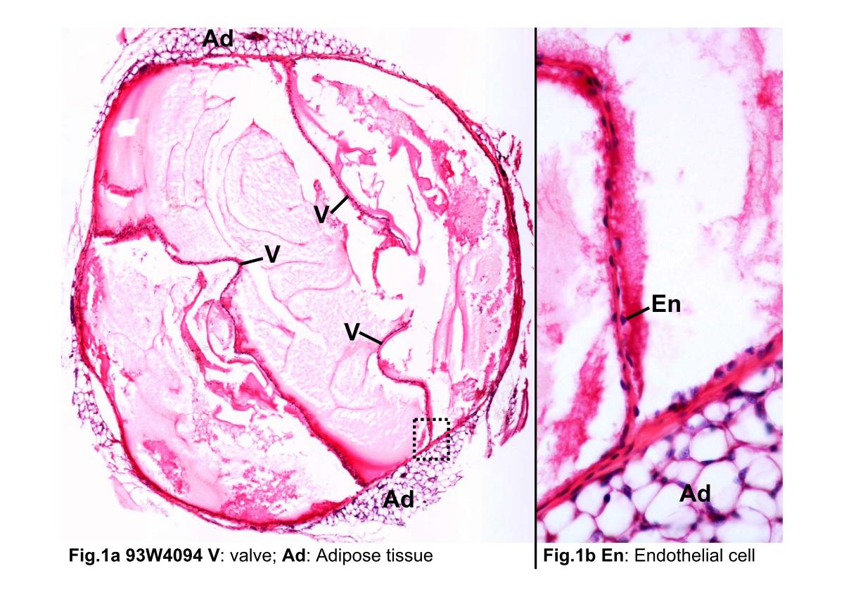block3_04.jpg - Fig.1a 93W4094 Lymphatic vessel (cs) H&E. Lymphaticvessels have the same tunics as blood vessels, but their wallsare always much thinner. This reflects the fact that lymphflows under very low pressure. To direct the flow of lymph,lymphatic vessels contain more valves (V) than veins. Theblack dashed line rectangle shows the orientation of figure1b.Fig.1b The valve consists of a single layer of endothelial cells(En) at each side.