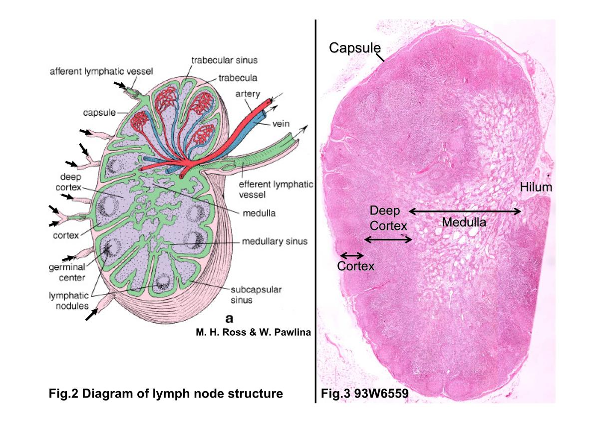 block3_06.jpg - Fig.2 Diagram of lymph node structure. Surrounding thelymph node is a capsule of dense connective tissue fromwhich trabeculae (pink) extend into the substance of the node.Under the capsule and adjacent to the trabeculae are,respectively, the subcapsular sinus and the trabecularlymphatic sinuses (green). Afferent lymphatic vessels (arrows)penetrate the capsule and empty into the subcapsularsinus. The subcapsular sinus and trabecular sinusescommunicate with the medullary sinuses.Fig.3 93W6559 Lymph node, H&E. The dense outer portionof the lymph node is the cortex. It consists of aggregations oflymphocytes organized as nodules and a nodule-free deepcortex. The innermost portion, the medulla, extends to thesurface at the hilum, where blood vessels enter or leave andwhere efferent lymphatic vessels leave the node. Surroundingthe lymph node is the capsule.