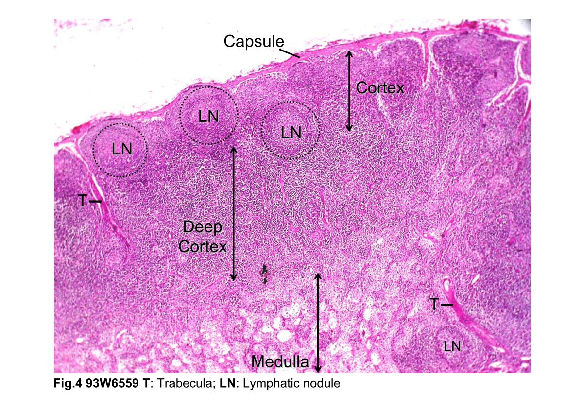 block3_08.jpg - Fig.4 Photomicrograph of a lymph node. This photo-micrograph shows the cortex, deep cortex, and medulla. Thecapsule is composed of dense connective tissue from whichtrabeculae (T) penetrate into the organ. The lymphatic nodules(LN) in the black dash line circles are the characteristic of theouter cortex. The deep cortex is nodule free. It consists ofdensely packed lymphocytes. In contrast to these areas, themedulla is a less dense area.