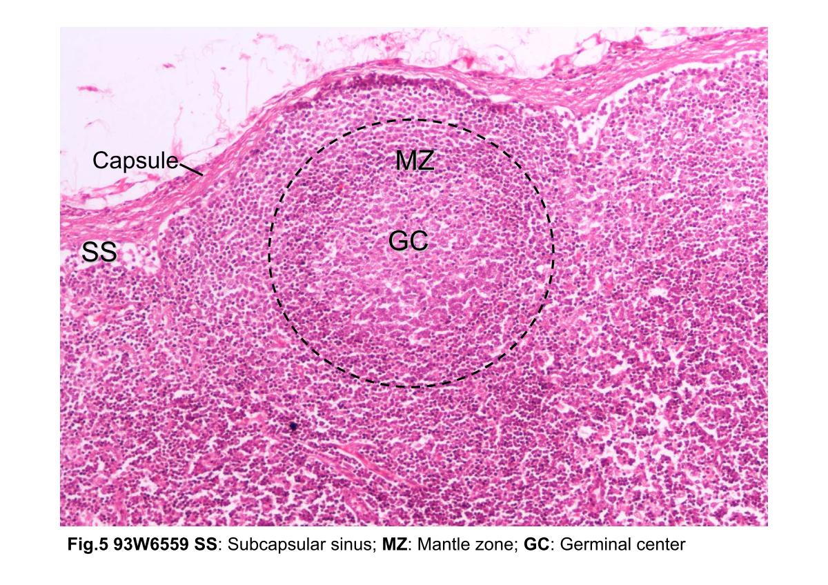 block3_10.jpg - Fig.5 Photomicrograph of a lymphatic nodule. The capsuleis composed of dense connective tissue. Below the capsule isthe subcapsular sinus (SS). The area (black dashed line)shows the lymphatic nodule with a pale germinal center (GC)and a darker stained mantle zone (MZ) surrounding it. B cellsproliferate and differentiate in the germinal centers.