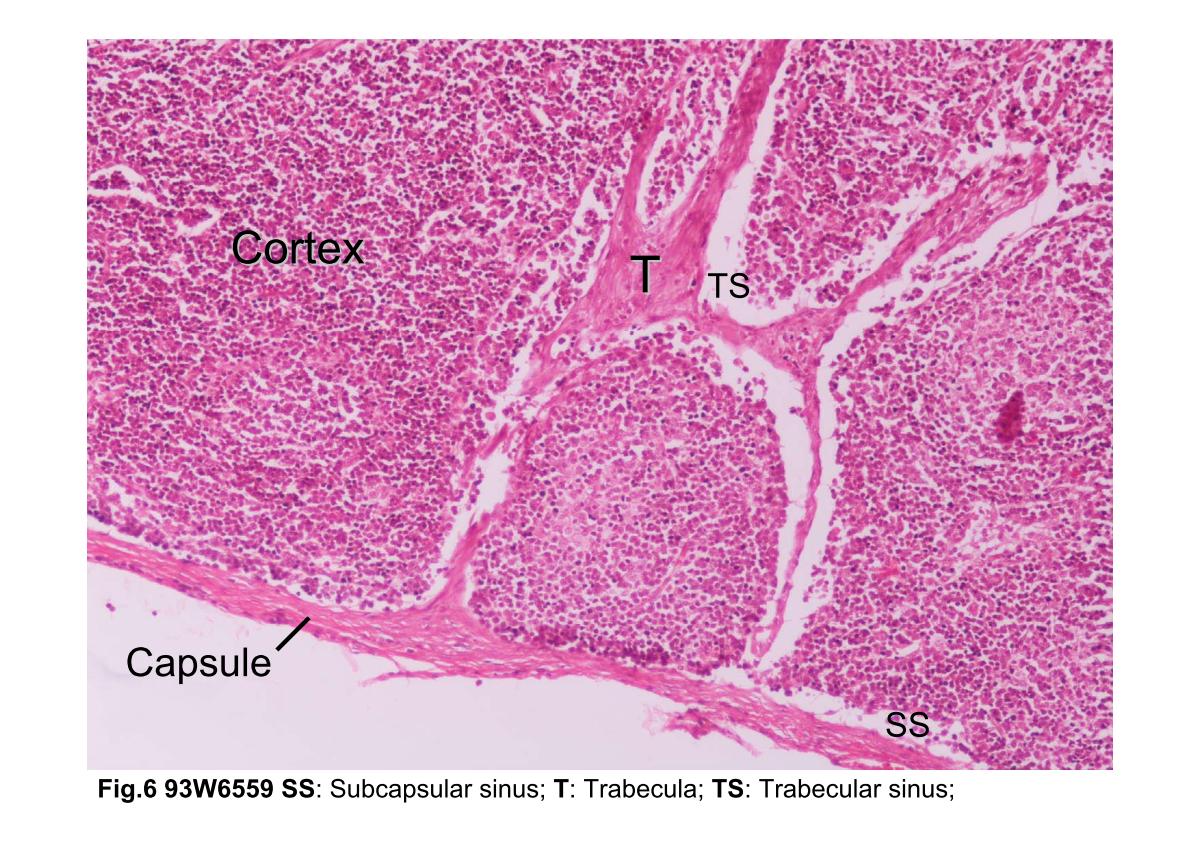 block3_12.jpg - Fig.6 Photomicrograph of a lymphatic nodule. The capsuleis composed of dense connective tissue from whichtrabeculae (T) penetrate into the organ. Immediately below thecapsule is the subcapsular sinus (SS), which receives lymphfrom the afferent lymphatic vessels after they penetrate thecapsule. The subcapsular sinus is continuous with thetrabecular sinuses (TS) that course along the trabeculae (T).