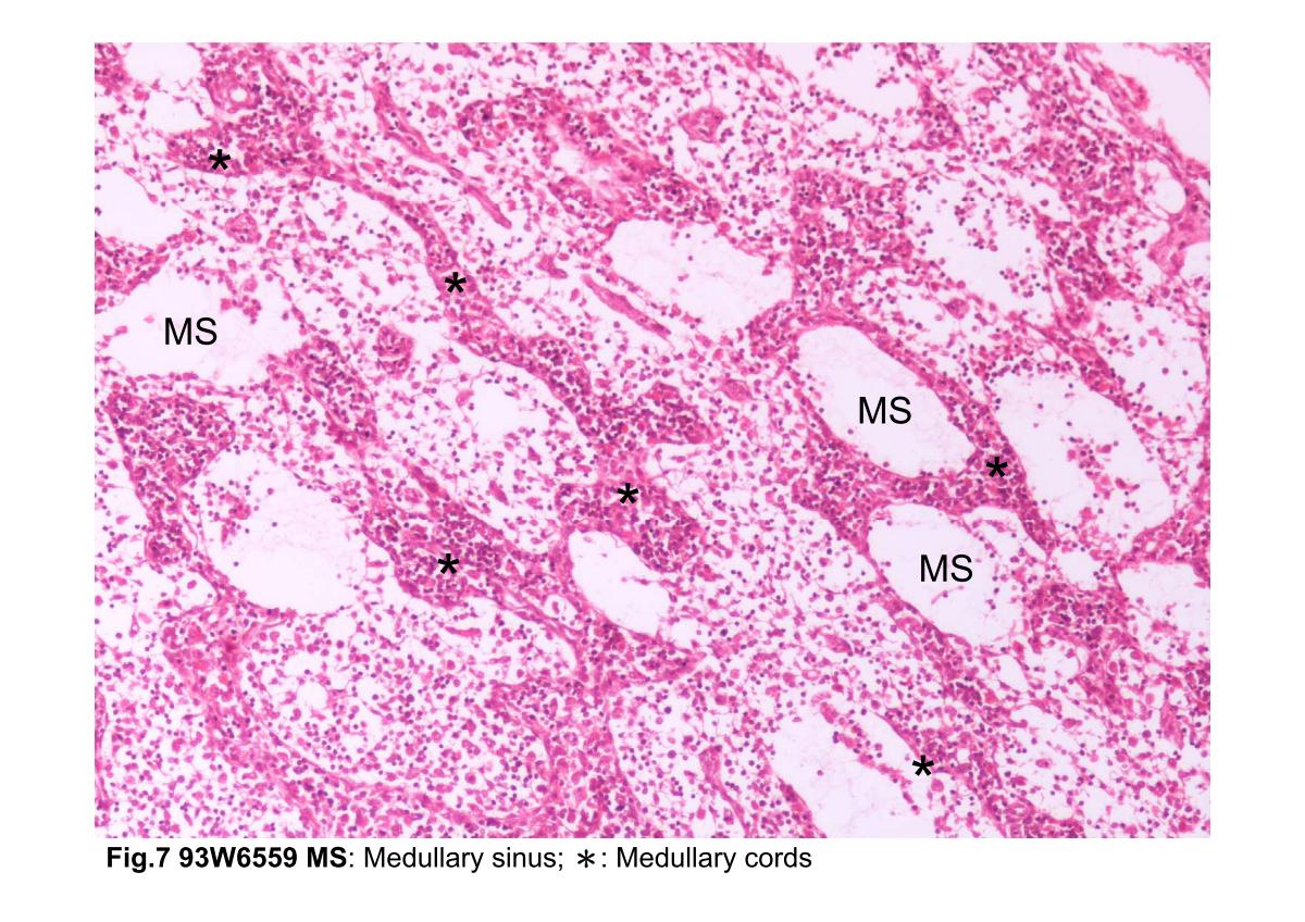 block3_14.jpg - Fig.7 Photomicrograph of the medulla of a lymph node.The medulla consists of narrow strands of anastomosinglymphatic tissue called medullary cords (*), separated bylight-appearing spaces, the medullary sinuses (MS). Themedullary sinuses receive lymph from the trabecular sinusesas well as lymph that has filtered through the cortical tissue.