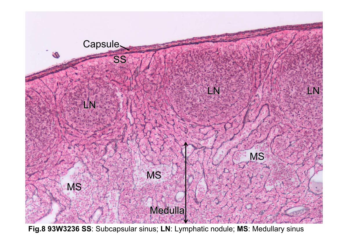 block3_16.jpg - Fig.8 93W3236 Reticular tissue m&nfr. The Manuel silvermethod makes the reticular fibers black, and the nuclear fastred stains the nuclei red. The main structural support for thelymph node is derived from the capsule and trabeculae, whichextend into the node. From these, a fine meshwork of reticularfibers extends throughout the node, providing a supportingframework for the mass of lymphocytes and accessory cellswithin the cortex and medullary cords. The reticular network isparticularly dense in the cortex, except for the follicular areaswhere it is relatively sparse. Compare this slide with the H&Estaining slide (93W6559) and find out the distribution ofreticular fibers only demonstrated by m&nfr staining.