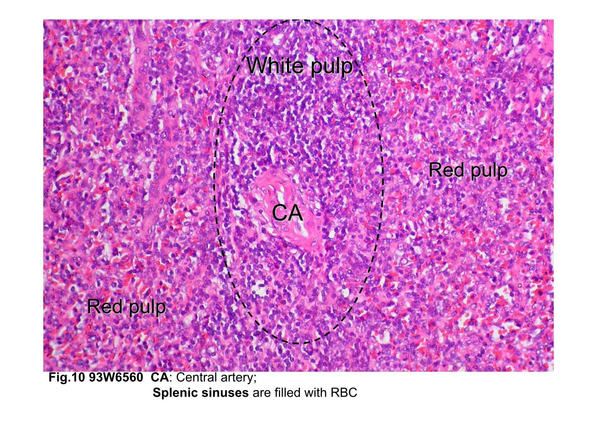 block3_20.jpg - Fig.10 93W6560 Spleen, H&E. This figure reveals at highermagnification of the spleen. The white pulp contains lymphatictissue that follows and ensheathes the central artery. The redpulp consists of splenic sinuses surrounded by splenic cords.The venous sinuses are filled with red blood cells and appearred in spleen, thus the name.
