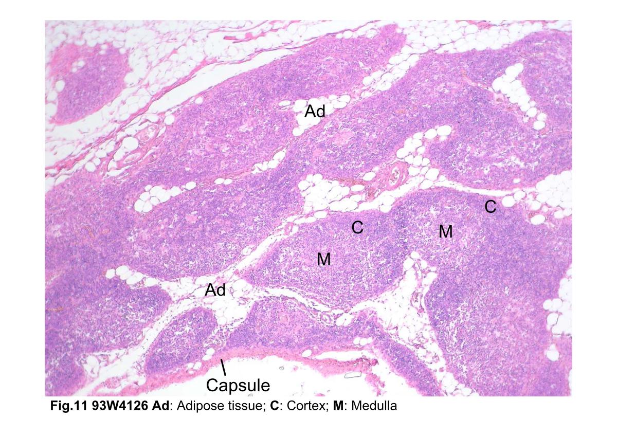 block3_22.jpg - Fig.11 93W4126 Thymus, H&E. Examination of the thymus atlow magnification reveals the lobules separated by adiposetissue (Ad). In the older thymus, much adipose tissue ispresent between the lobules. Each lobule is composed of adark-staining basophilic cortex (C) and a lighter-stainingmedulla (M). The cortex contains numerous densely packedlymphocytes, whereas the medulla contains fewerlymphocytes and is consequently less densely. The lobulesare not completely separate units; rather, they areinterconnected.