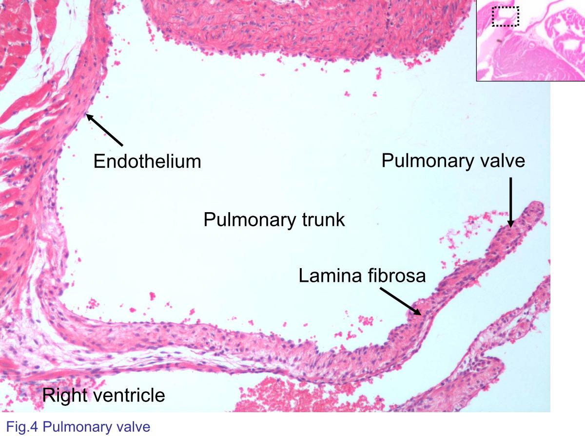 block4_08.jpg - Fig.4 Photomicrograph of pulmonary valve. The heartvalves consist of fibroelastic tissue, the lamina fibrosa. Thesurfaces covered by a thin layer of endothelium continuouswith the lining of both the heart chambers and great vessels.This micrograph shows the pulmonary valve arising at thejunction of the walls of the right ventricle and the pulmonarytrunk.