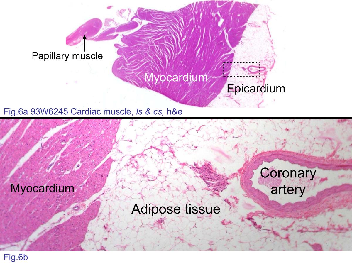 block4_12.jpg - Fig.6a 93W6245 Cardiac muscle, ls & cs, h&e. The smallmuscle bundles within the heart chambers are called papillarymuscles in anatomy. They are lined by endothelium. The blackdashed line rectangle shows the orientation of figure 6b.Fig.6b The visible coronary artery surrounded by adiposetissue lies in the epicardium.      Intercalated discs