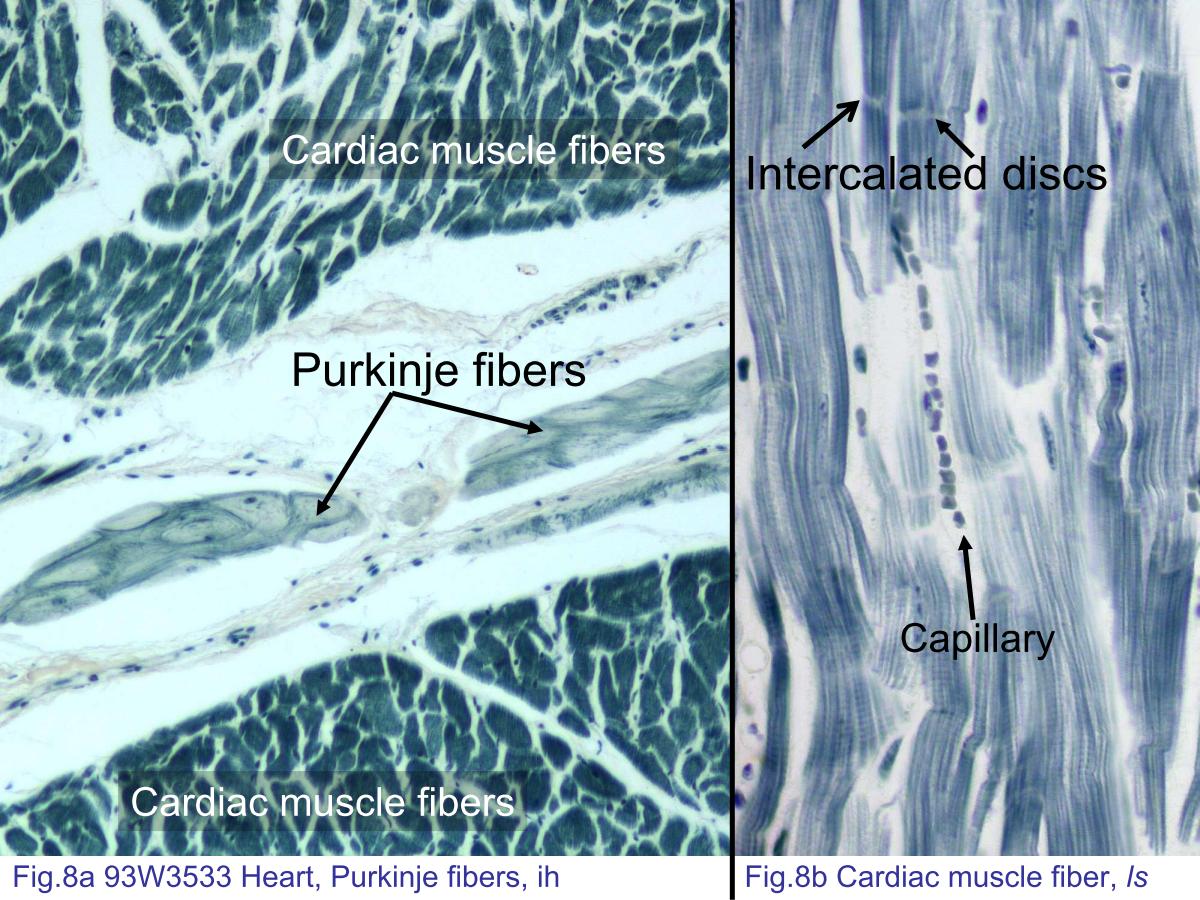 block4_16.jpg - Fig.8a 93W3533 Heart, Purkinje fibers, ih. Purkinje fibersare the components of the heart¡¦s conduction system. Theyare more easily observed in a slide stained with ironhematoxylin. While most common in the subendothelial space,they can also be observed in the myocardium. ComparePurkinje fibers with cardiac muscle fibers. Note largernumbers of myofibrils and smaller cell size in cardiac musclefibers. The Purkinje fibers contain large amounts of invisibleglycogen particles, which appear as pale-staining regions thatoccupy the center portion of the cell surrounded by themyofibrils.Fig.8b Cardiac muscle fiber, ls. Iron hematoxylin staining ofcardiac muscle highlights the cross striations and intercalateddiscs. The red blood cells are stained in black dots. Thecapillary diameter is about the same size as a red blood cell.In longitudinal section, the capillaries will look to appear asrows of red blood cells.