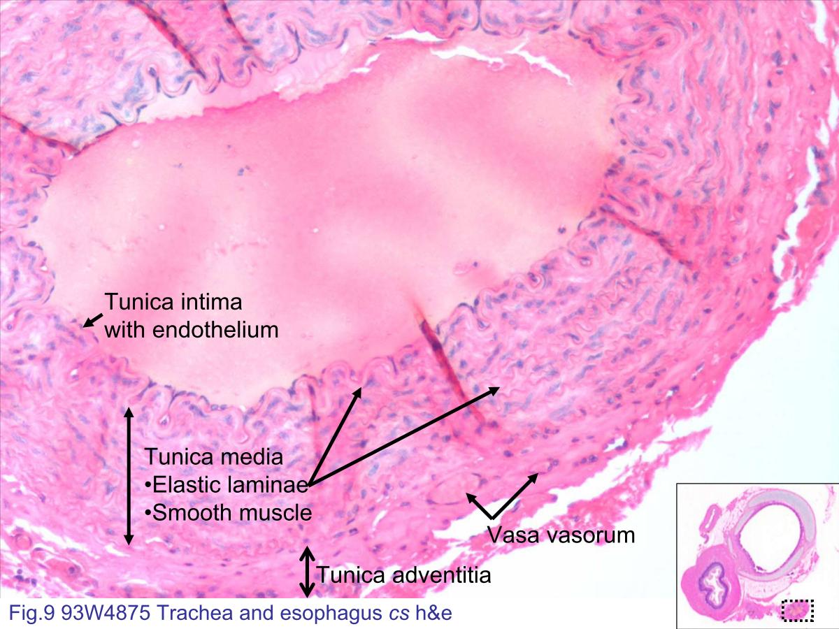block4_18.jpg - Fig.9 93W4875 Trachea and esophagus cs h&e. Note theelastic artery in the slide. The characteristics of the elasticarteries described in figure 5. However, the elastic lamellaeare fewer and not so obvious than the lamellae in aorta. Thecollagen fibers and smooth muscle cells are more in the tunicamedia in this artery. The tunica intima consists of a singlelayer of endothelial cells. The tunica adventitia is theoutermost part. It consists mainly of connective tissue andcontains the blood vessels (vasa vasorum) that supply thearterial wall.