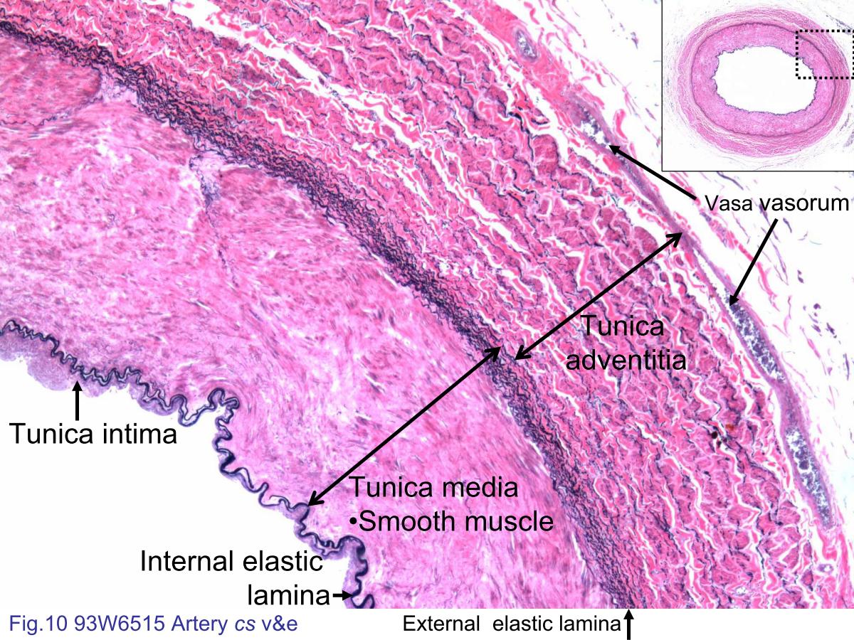 block4_20.jpg - Fig.10 93W6515 Artery cs v&e. This slide is stained withVerhoeff's stain to visualize the elastic fibers, and with eosin toshow the cellular structures. Muscular arteries have moresmooth muscle and less elastin in the tunica media thanelastic arteries. The muscular arteries are characterized by alayer of internal elastic lamina separating the tunica intimafrom the tunica media. The less prominent and more variableexternal elastic lamina lies between the tunica media and theadventitia. The tunica intima consists of an endothelial liningand a small amount of connective tissue. However, nucleus ofthe endothelial cells can¡¦t be observed by the v&e stainingmethod. The tunica adventitia is composed of collagen fibers(pink), elastic fibers (black) and vasa vasorum.