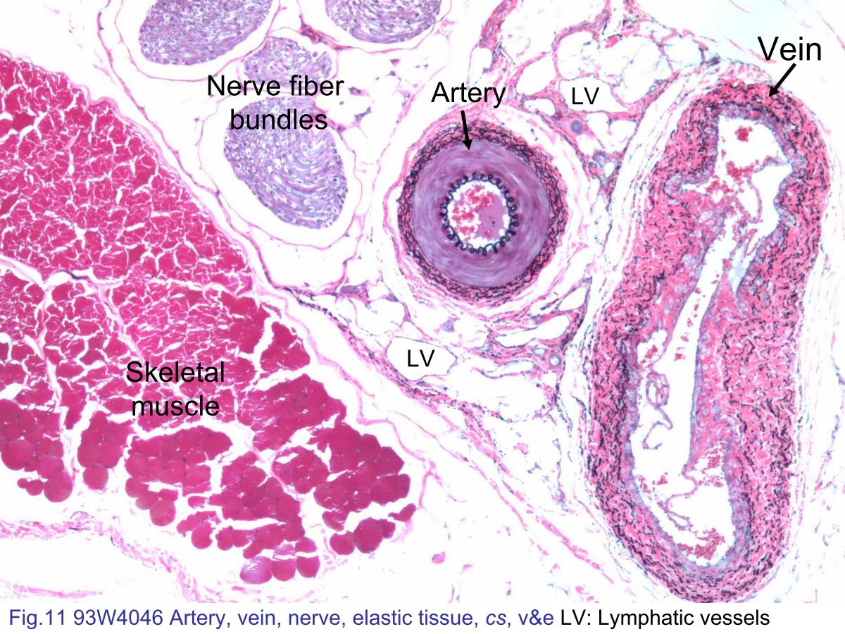 block4_22.jpg - Fig.11 93W4046 Artery, vein, nerve, elastic tissue, cs, v&e.There are many vessels: a muscular artery, a medium vein,several lymphatic vessels (LV), nerve fiber bundles, and amass of skeletal muscle tissue in the slide. Veins usuallyaccompany arteries as they travel in the loose connectivetissue. Compare the structure of blood vessels with the one oflymphatic vessels (Review block 3). Compare the skeletalmuscle fibers with the cardiac muscle fibers observed before.The structure of nerve fiber bundles will be demonstrate inblock 7.