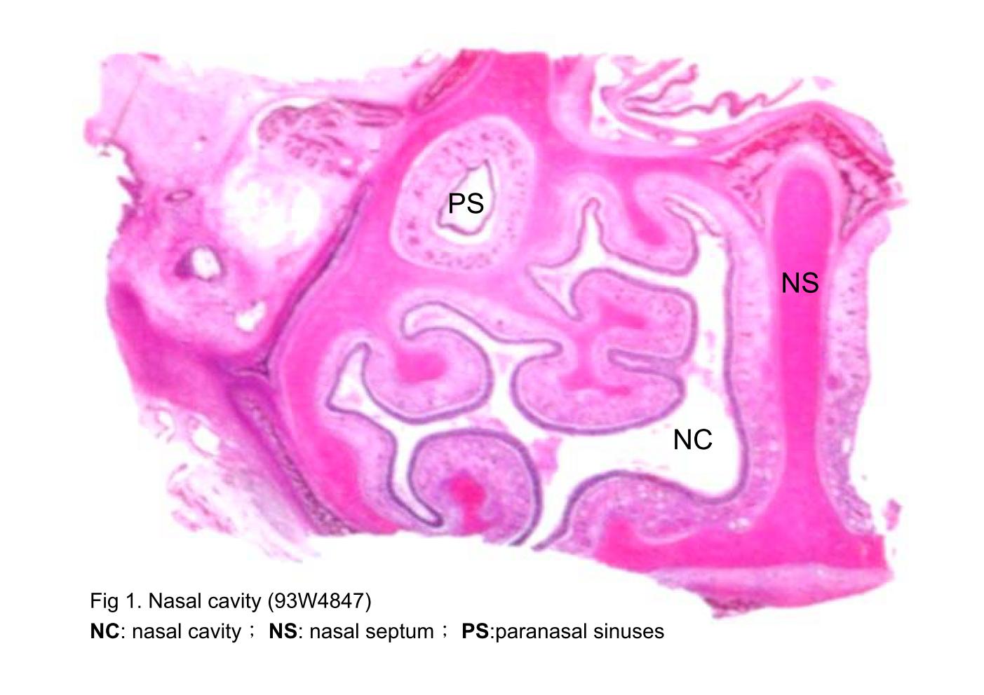 block9_05.jpg - Fig 1. Nasal cavity (93W4847)The nose is subdivided into two nasal cavities (NC) by the cartilaginous the nasal septum (NS). The nasal cavities and paranasal sinuses (PS) are lined by respiratory mucosa.