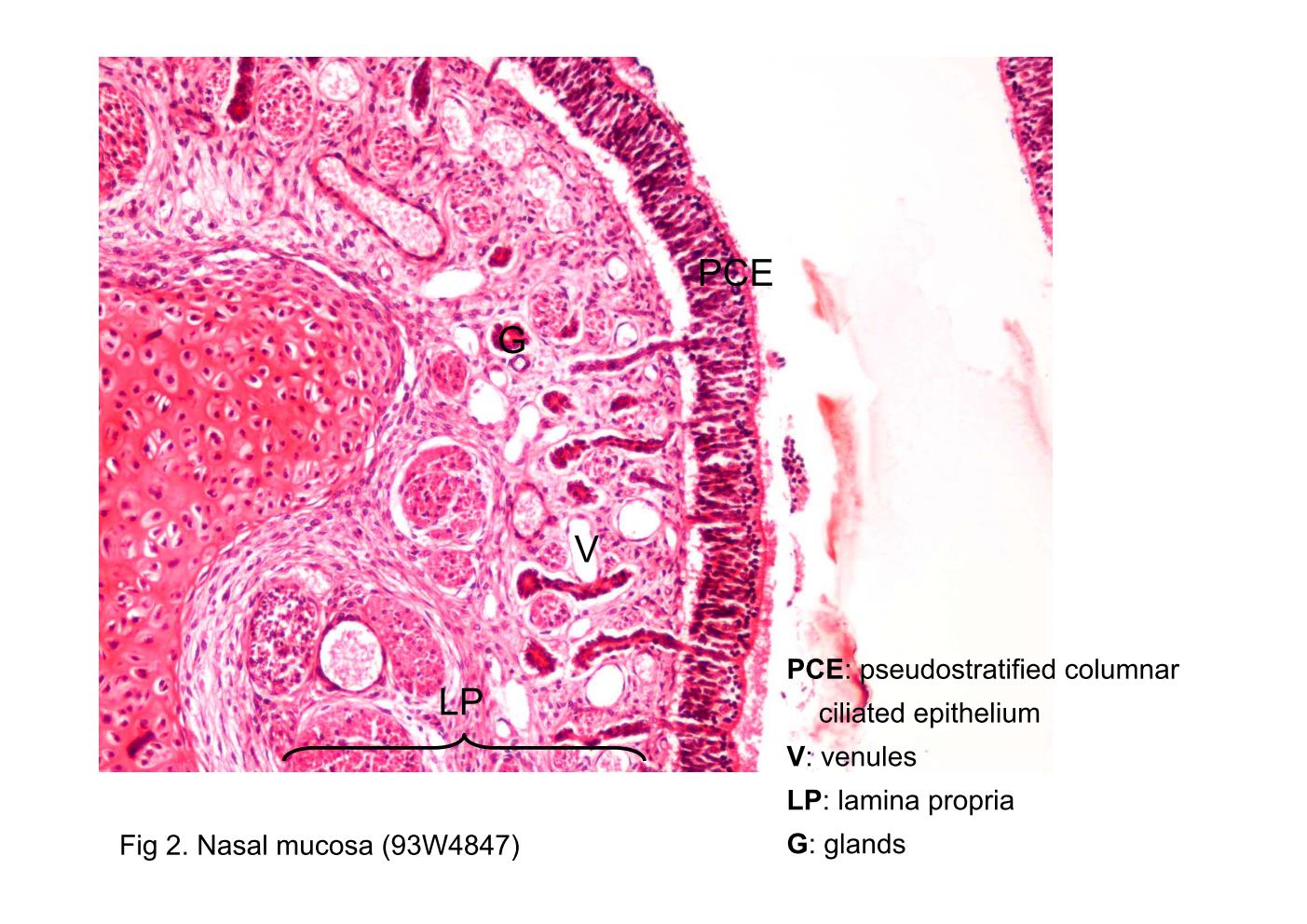 block9_07.jpg - Fig 2. Nasal mucosa (93W4847)The respiratory mucosa consists of a pseudostratified columnar ciliated epithelium (PCE) supported by a richly vascular (V) lamina propria (LP) containing mixed glands (G).