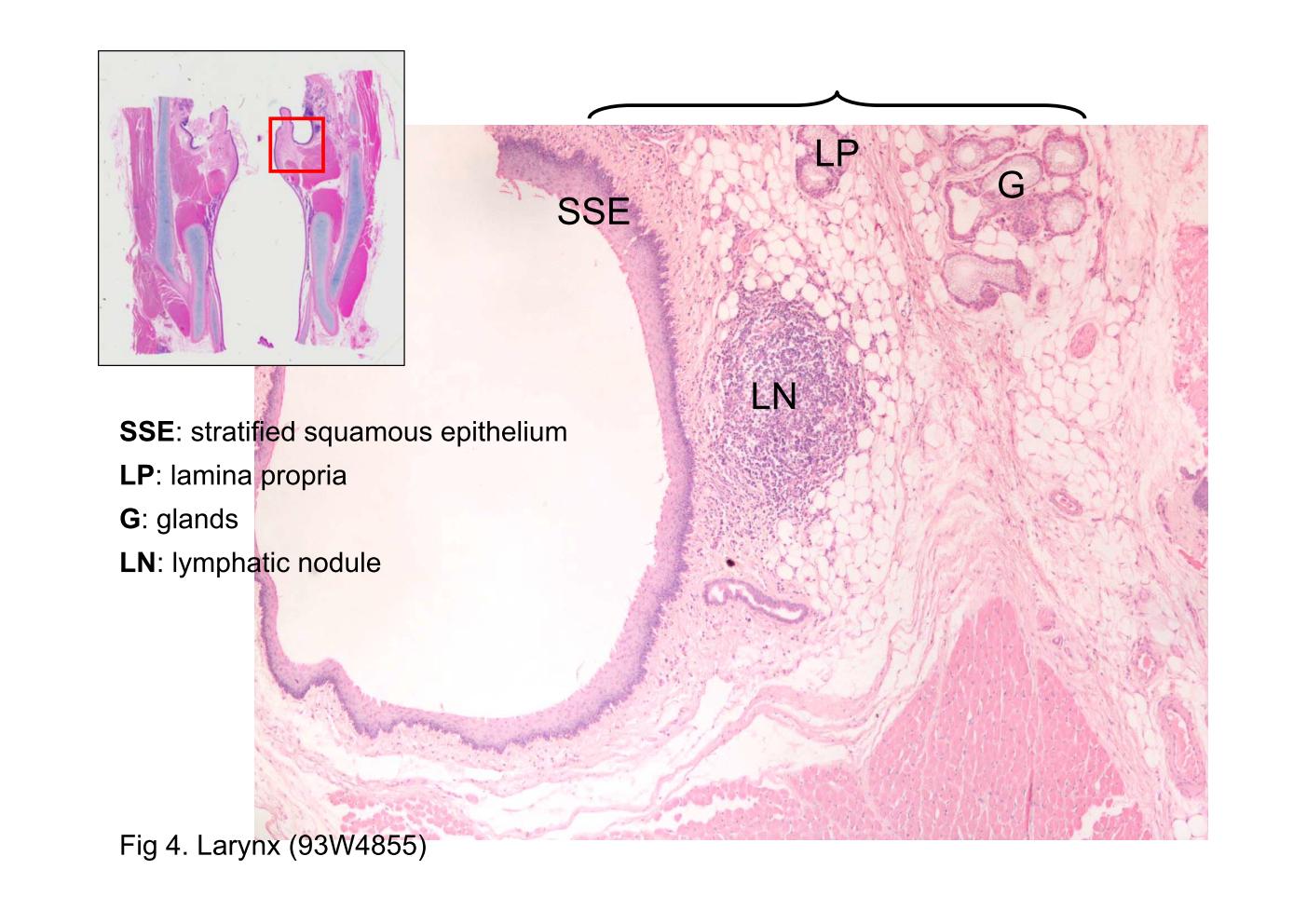 block9_11.jpg - Fig 4. Larynx (93W4855)The surfaces of the vocal fold are lined by stratified squamous epithelium (SSE). The lamina propria (LP) consists of loose connective tissue in which glands (G) and lymphatic nodule (LN) are present.