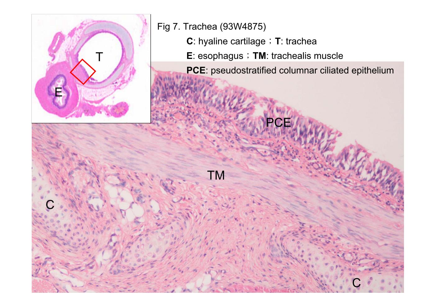 block9_17.jpg - Fig 7. Trachea (93W4875)The trachealis muscle (TM), a band of smooth muscle that fills the gap between the posterior ends of the C-shaped tracheal cartilages (C) is shown here (adjacent to the esophagus). Typical respiratory (ciliated pseudostratified columnar) epithelium lines the trachea and primary bronchi.