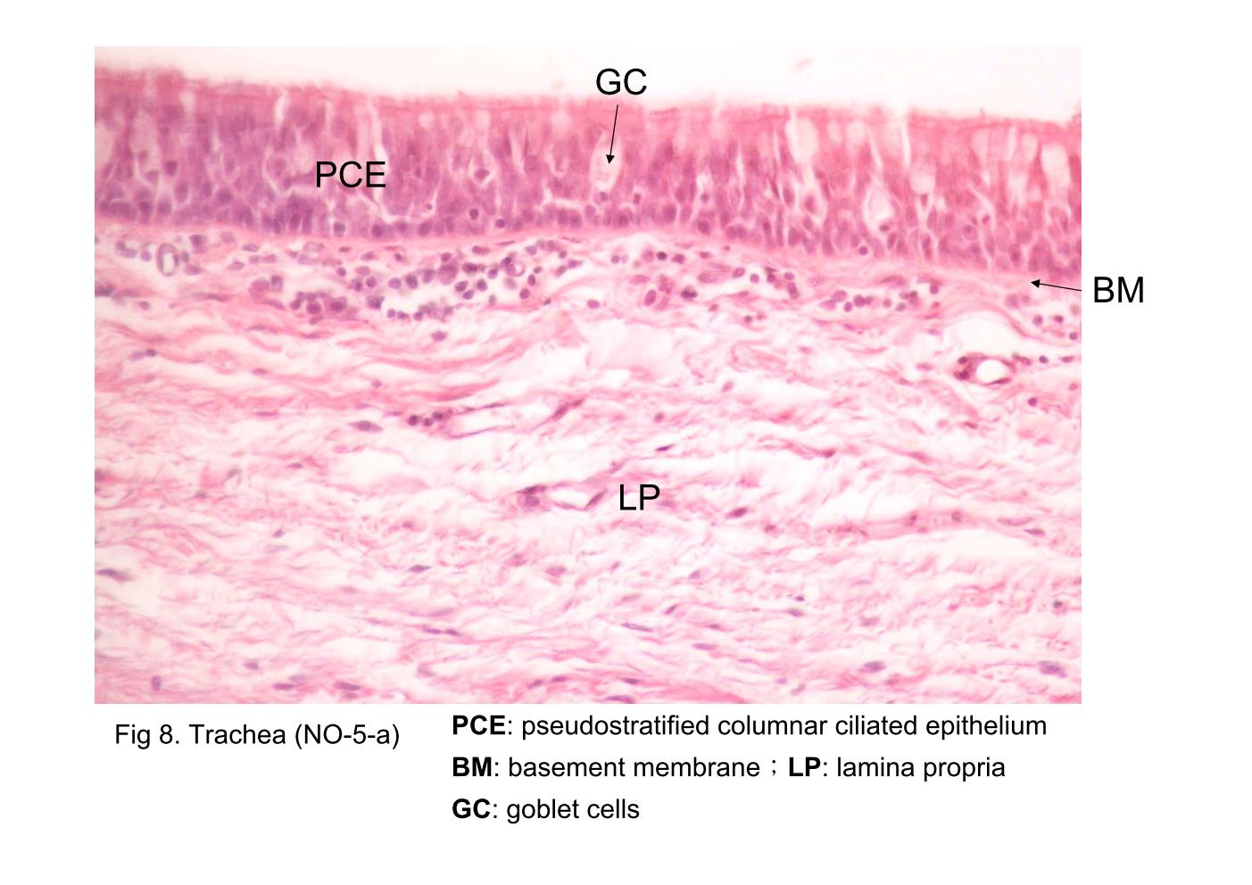block9_19.jpg - Fig 8 & 9. Trachea (NO-5-a)The wall of the trachea shows the pseudostratified columnar ciliated epithelium (PCE) located on a well-developed basement membrane (BM). A thin lamina propria (LP) and a dense thick submucosa (SM) underlie the respiratory epithelium. Numerous goblet cells (GC) are evident as clear ovoid spaces in the respiratory epithelium. Seromucous glands (tracheal glands) (TG) are seen in the submucosa.