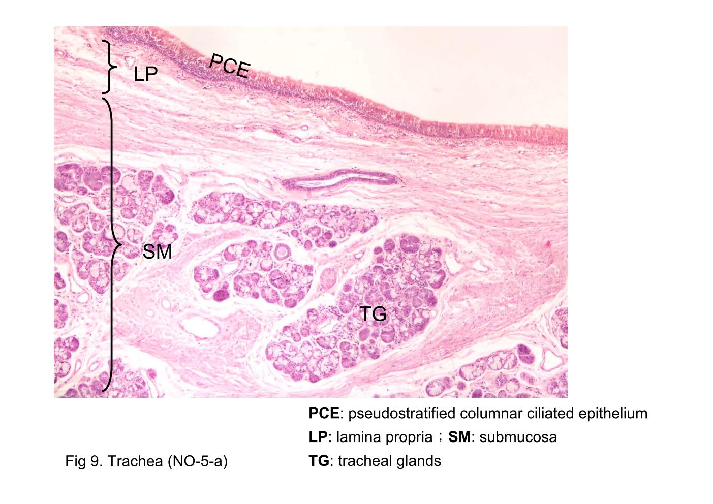 block9_20.jpg - Fig 8 & 9. Trachea (NO-5-a)The wall of the trachea shows the pseudostratified columnar ciliated epithelium (PCE) located on a well-developed basement membrane (BM). A thin lamina propria (LP) and a dense thick submucosa (SM) underlie the respiratory epithelium. Numerous goblet cells (GC) are evident as clear ovoid spaces in the respiratory epithelium. Seromucous glands (tracheal glands) (TG) are seen in the submucosa.