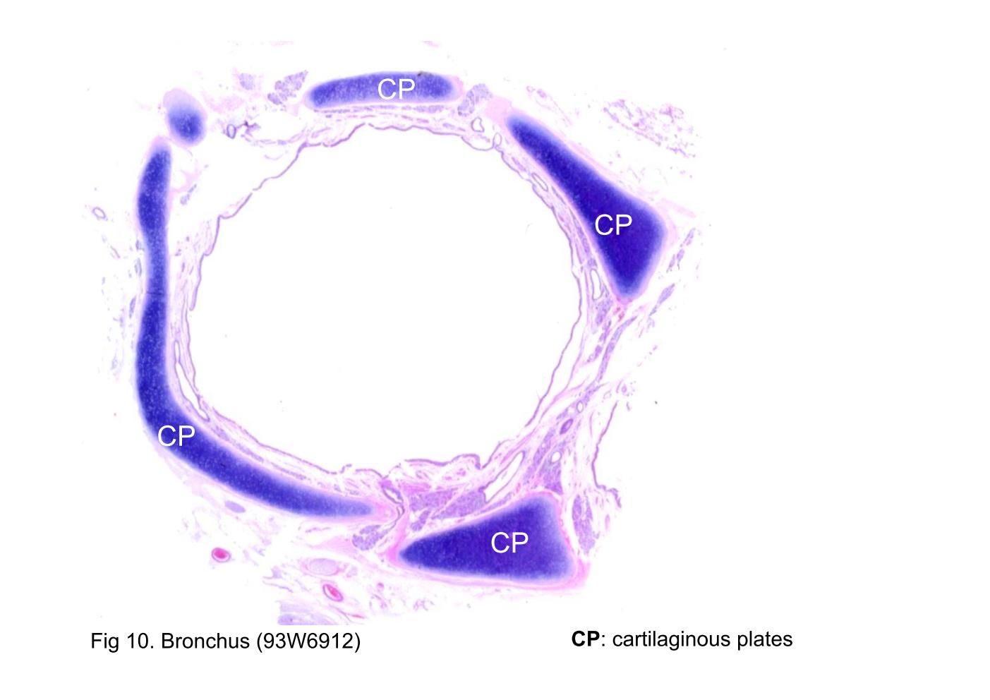 block9_22.jpg - Fig 10. Bronchus (93W6912)Within the bronchus, the cartilaginous plates (CP) are arranged into flattened, interconnected plates (sometimes overlapping) rather than discrete C-shaped cartilages as in the trachea.