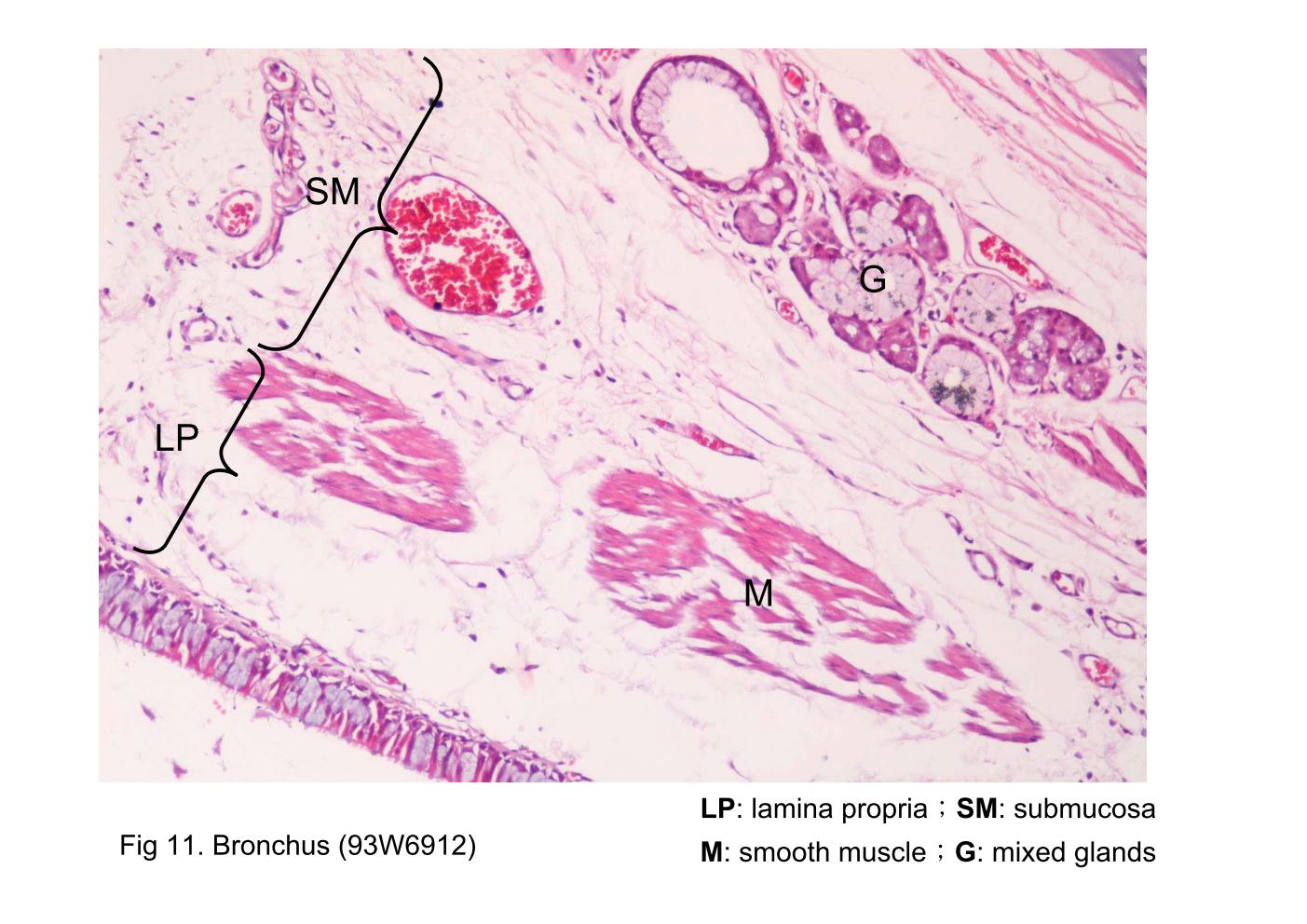 block9_24.jpg - Fig 11. Bronchus (93W6912)The basic structure of the bronchi (B) is similar to that of the trachea, but differs in details, as follows: The lamina propria (LP) is separated from the submucosa (SM) by a discontinuous layer of smooth muscle (M) which becomes progressively more prominent in smaller airways. The submucosa layer contains fewer mixed glands (G).