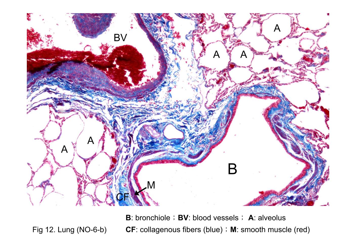 block9_26.jpg - Fig 12. Lung (NO-6-b)A typical bronchiole is shown here. Blood vessels (BV) are adjacent to the bronchiole. The main features of the bronchiolar wall evident in the figure are bundles of smooth muscle (M) and the lining epithelium. The connective tissue is minimal and, at this low magnification, not conspicuous. Nevertheless, the connective tissue is present and separates the muscle into bundles. The connective tissue contains collagenous fibers (CF). Glands are not present in the wall of the bronchiole. Surrounding the bronchiole, are the air spaces or alveoli (A) of the lung.
