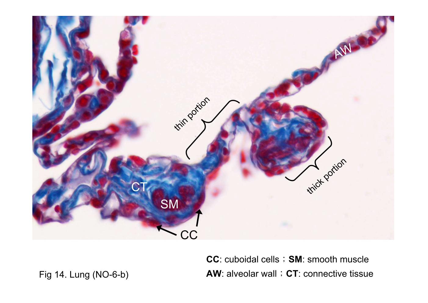 block9_30.jpg - Fig 14. Lung (NO-6-b)The wall of the respiratory bronchiole consists of alternating thick and thin portions. The thin portion consists of recesses that have a wall similar to that of the alveoli (A) and thus capable of gas exchange. The thick portion has a wall formed by small cuboidal cells (CC) that appear to rest on a small bundle of smooth muscle (M, eosinophilic material) and is surrounded by a thin investment of connective tissue (CT). The thin regions have a wall similar to the alveolar wall (AW).