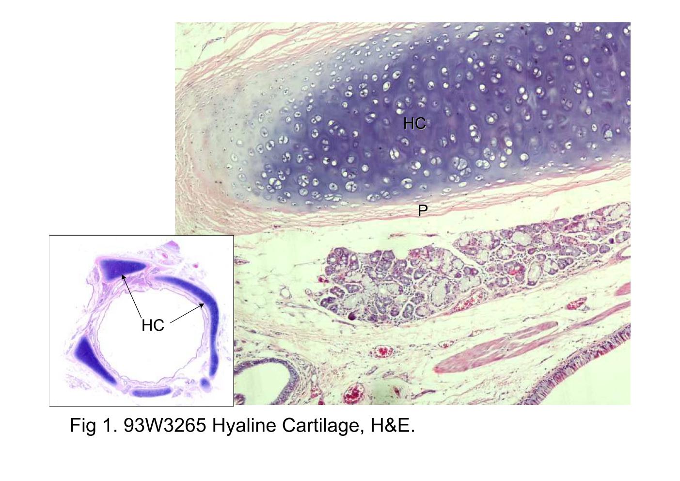block6-1_05.jpg - Fig 1. 93W3265 Hyaline Cartilage, H&E.Hyaline cartilage (HC) is the most common type of cartilagethough the whole body and is also found in the bronchi (asshown here). In the wall of the bronchus, the cartilaginousplates are arranged into flattened, discontinuous plates. Thecartilaginous plates are surrounded by the perichondrium (P).