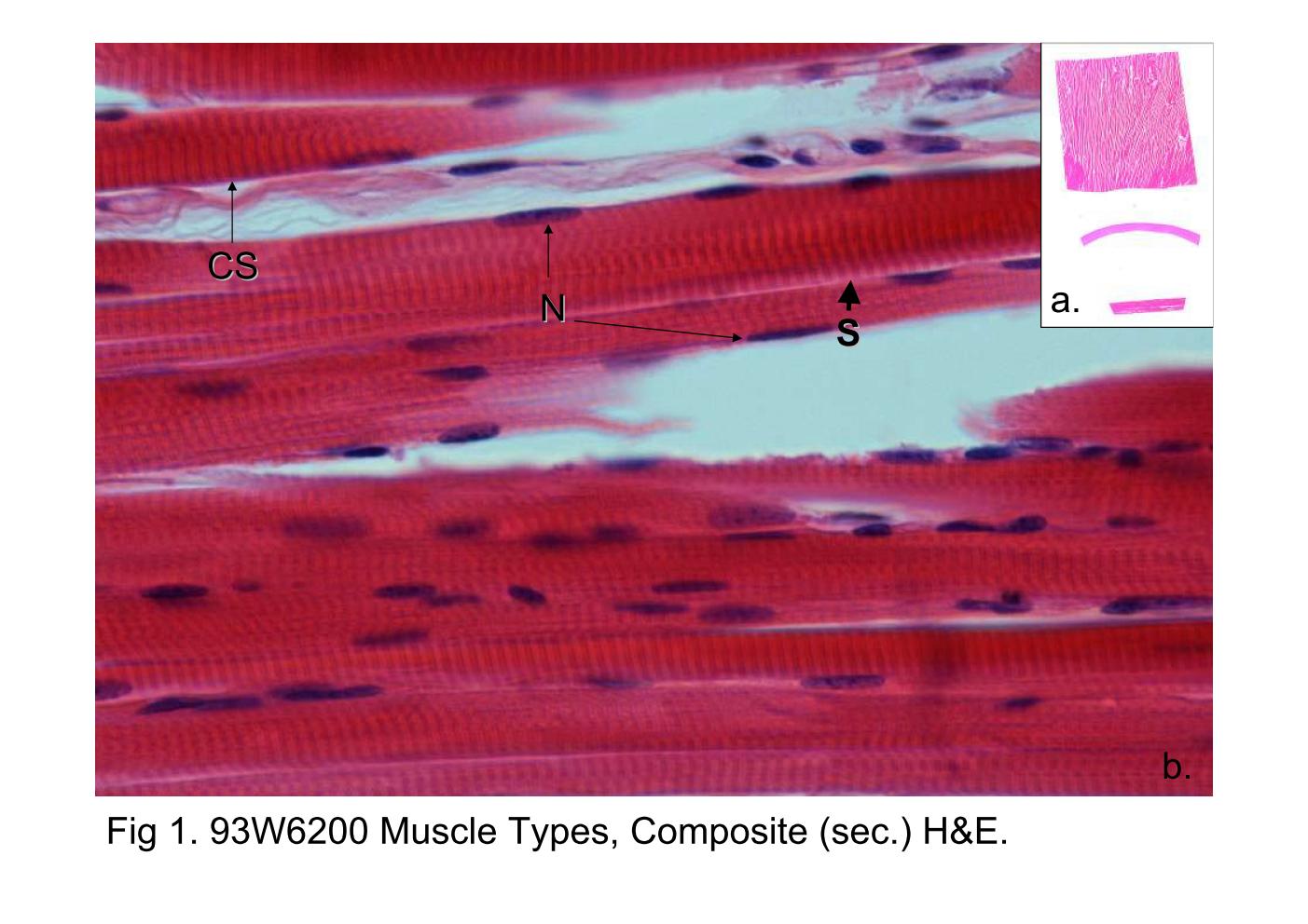 block6-2_05.jpg - Fig 1. 93W6200 Muscle Types, Composite (sect) h&e.Fig 1a. There are three tissues in this slide: upper, cardiacmuscle; middle, smooth muscle; lower, skeletal muscle.A longitudinal section of skeletal muscle fibers is shown in Fig1b. Cylindrical skeletal muscle fibres arranged in parallel,unbranched patterns with multinuclei (N, arrow) where isperipherally location. The most important characteristic ofmuscle fibers are the cross-striations (CS) appearance andbetween two striation is a intact functional unit, calledsacromere (S) (upper right, arrow head).